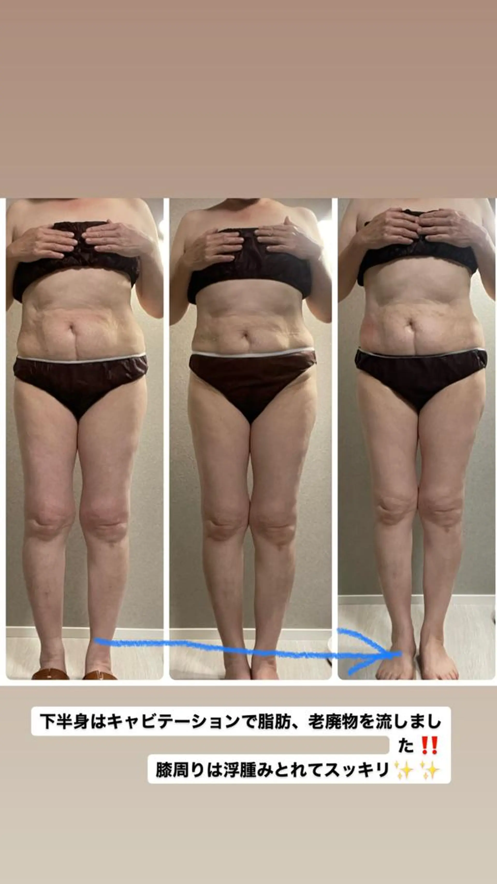 エステ／ネイル/脱毛 R.Msalonのネイルデザイン