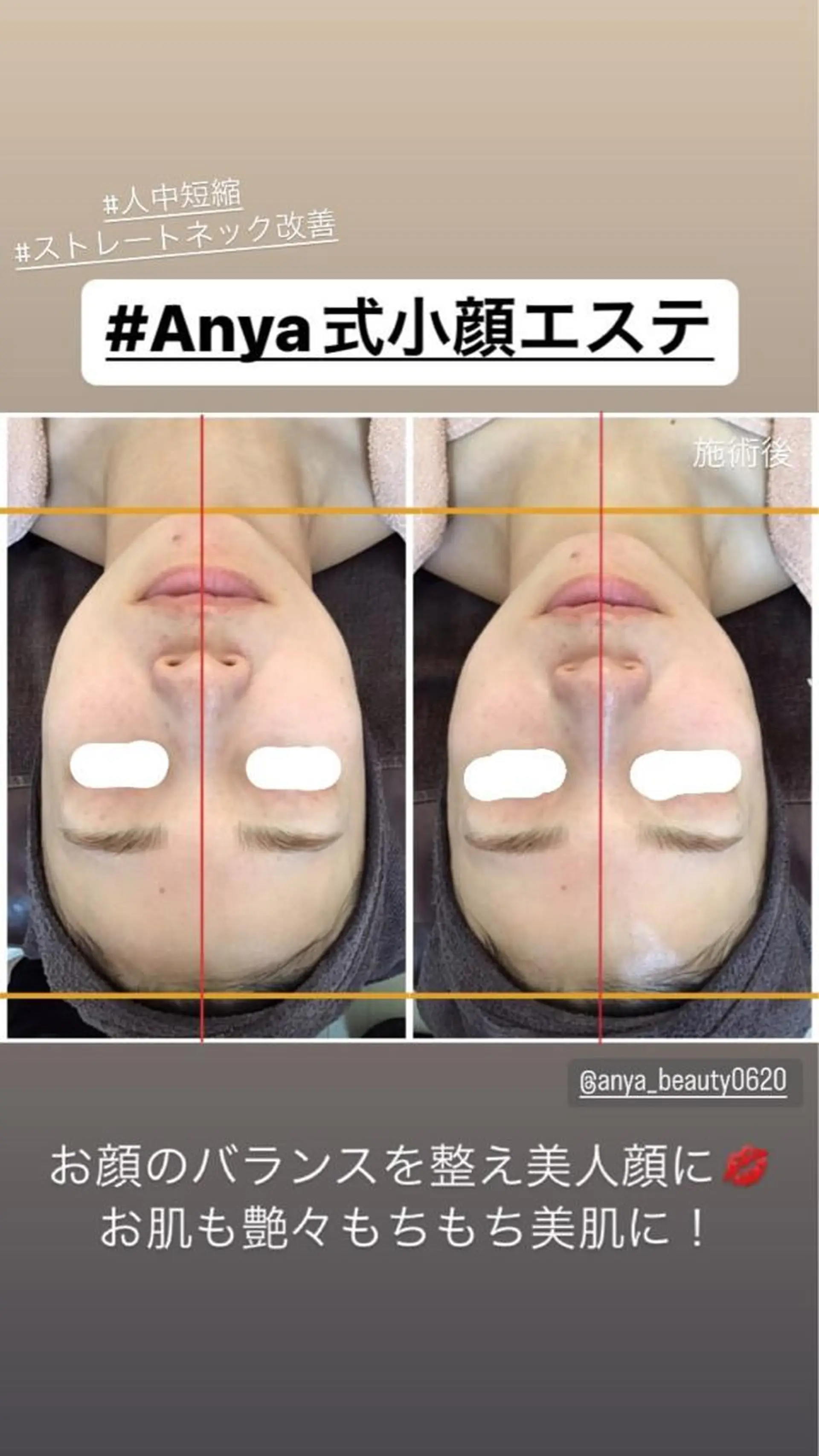 エステ Anya Beautyのエステ・リラクイメージ