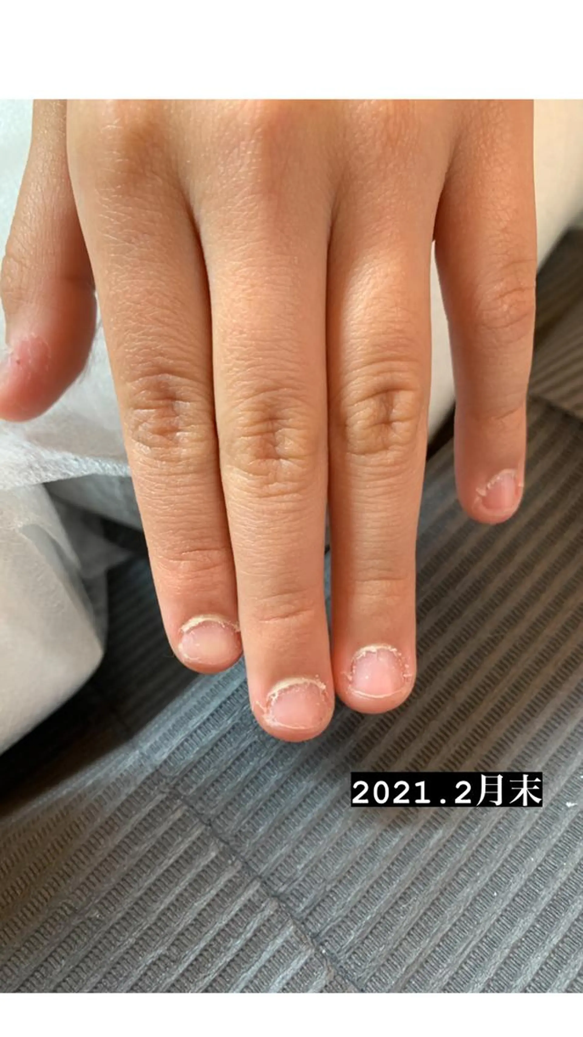 ネイル 木下 ゆみのネイルデザイン