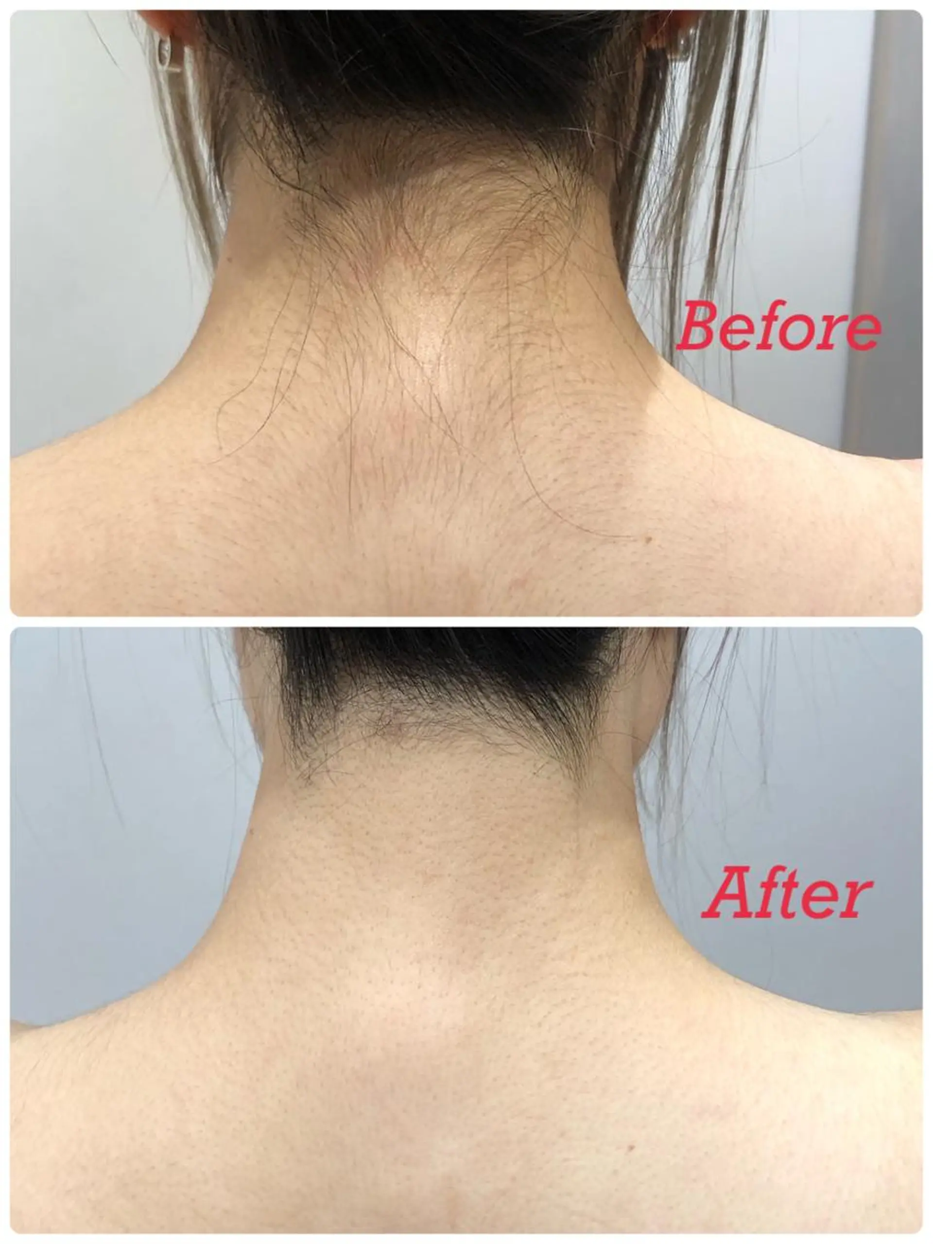 脱毛 EARTH 小林 郁海のエステ・リラクイメージ