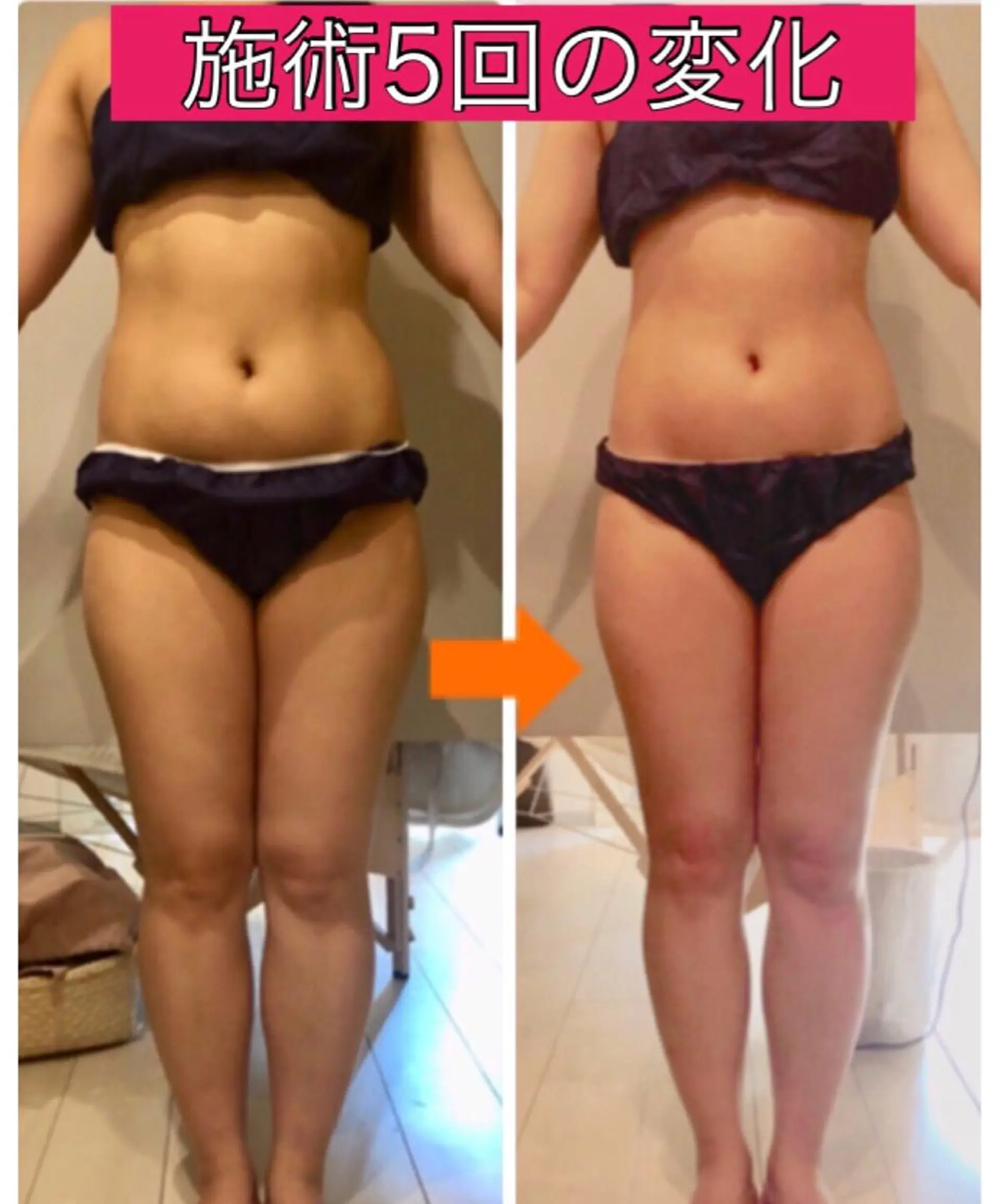 ショート カラー パーマ ヘアアレンジ メンズ キッズ ネイル マツエク・マツパ ‍痩身＆ボディ 結果出し🌟丹野のエステ・リラクイメージ