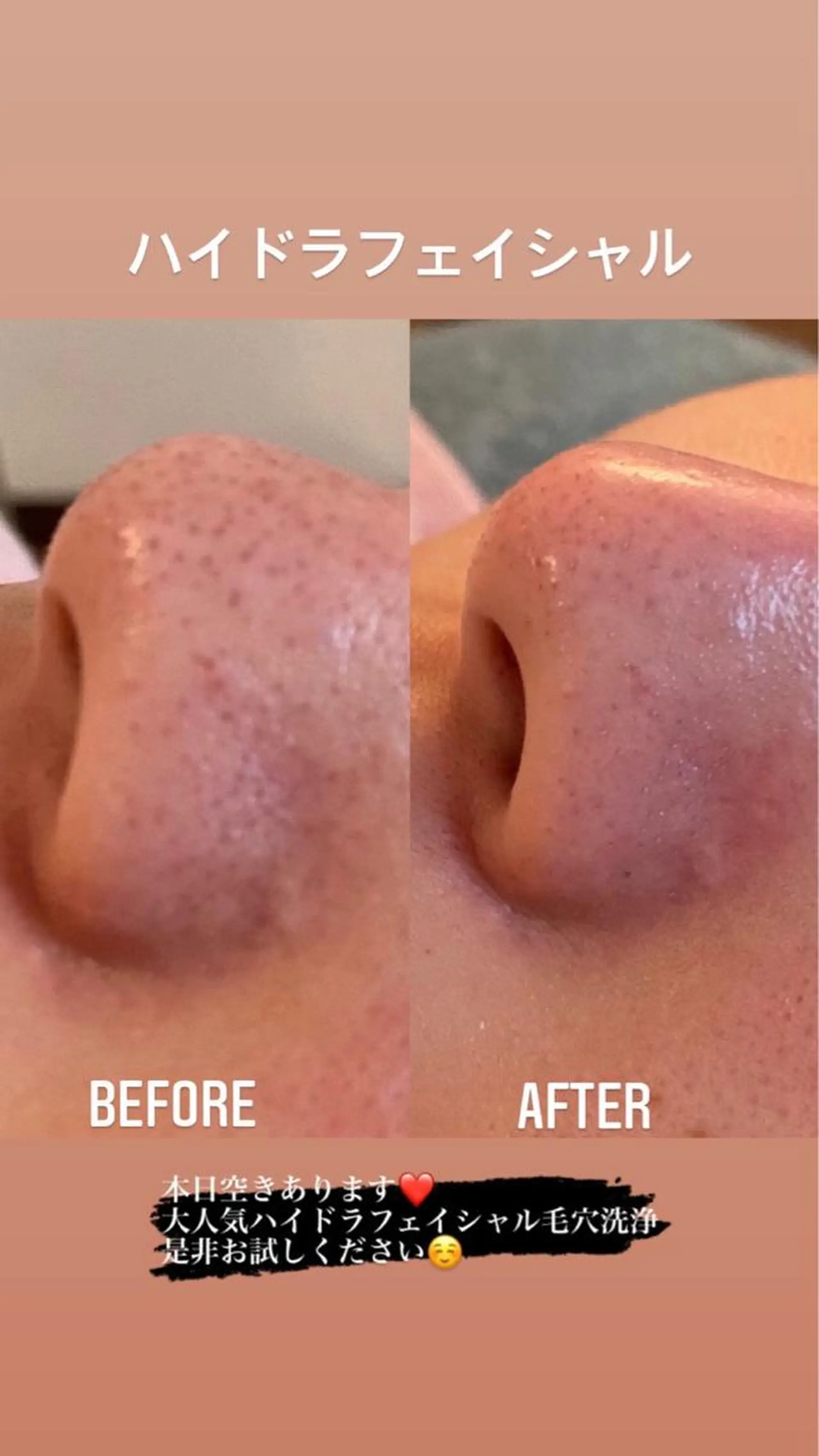 エステ VERY VERY九条店所属・VERY VERY 🌹九条店のエステ・リラクイメージ