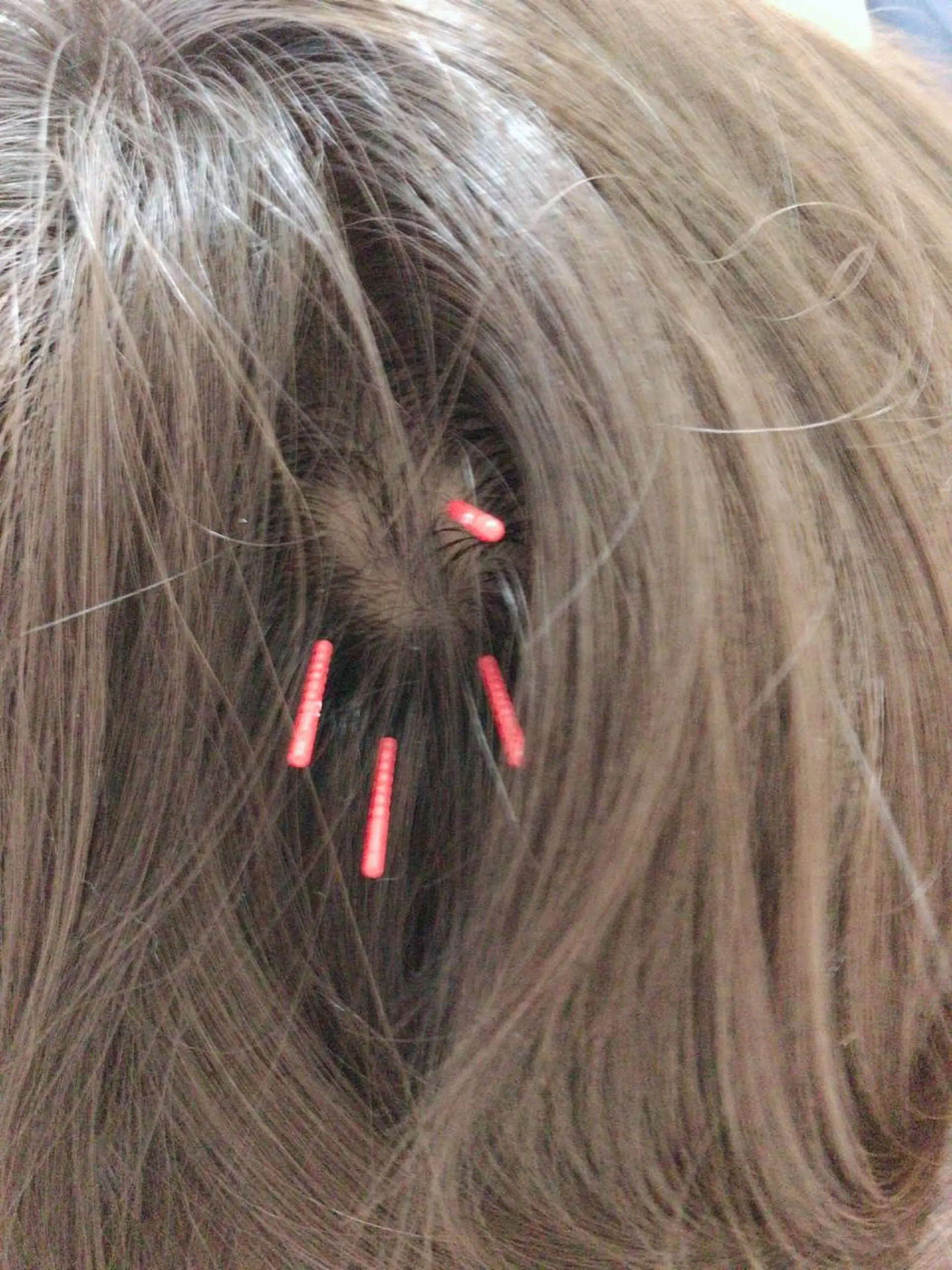 やまだ鍼灸接骨院（やまだしんきゅうせっこついん）所属・山田 晃のエステ・リラクイメージ