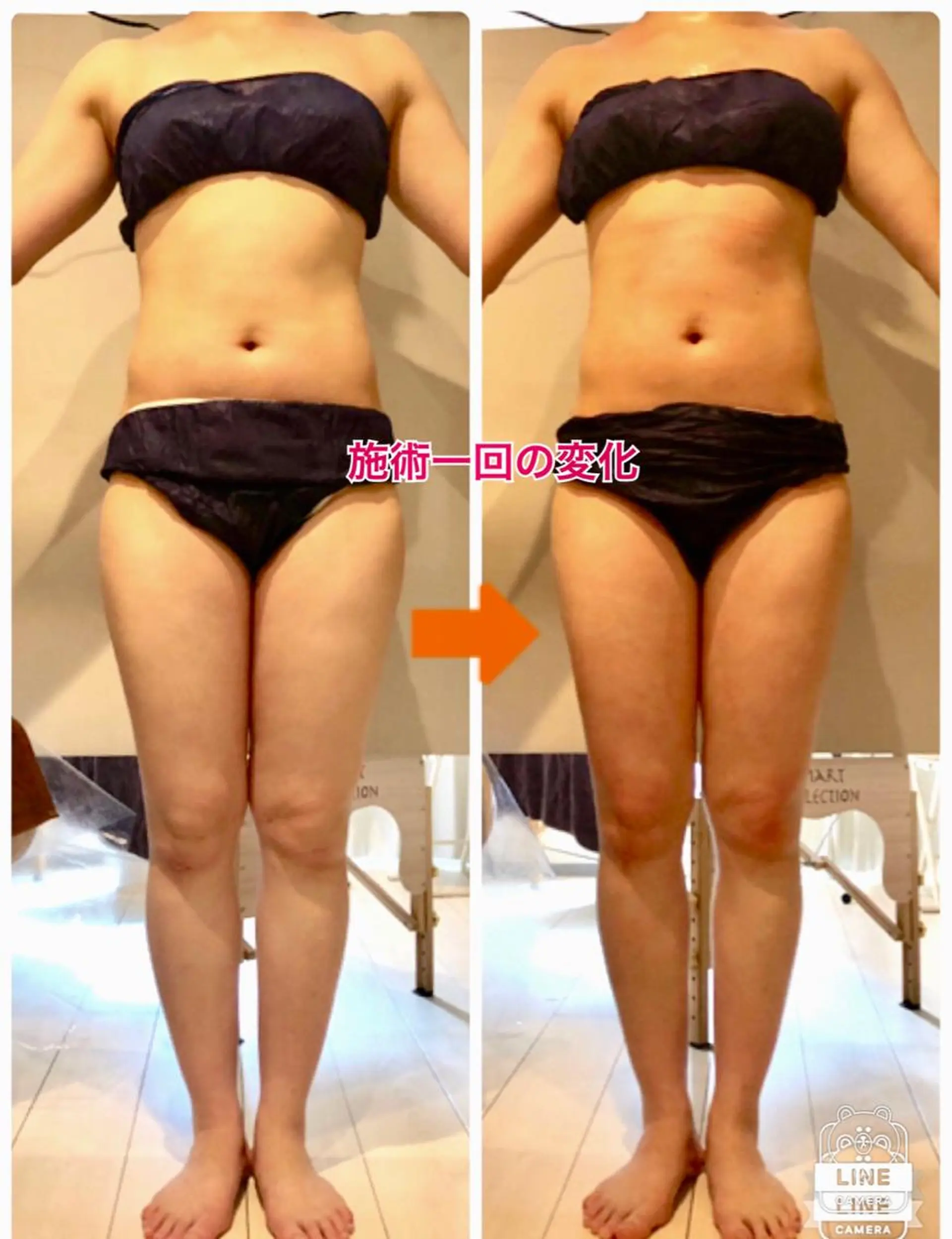 ロング カラー パーマ ヘアアレンジ メンズ キッズ ネイル マツエク・マツパ トリートメント ‍痩身＆ボディ 結果出し🌟丹野のエステ・リラクイメージ