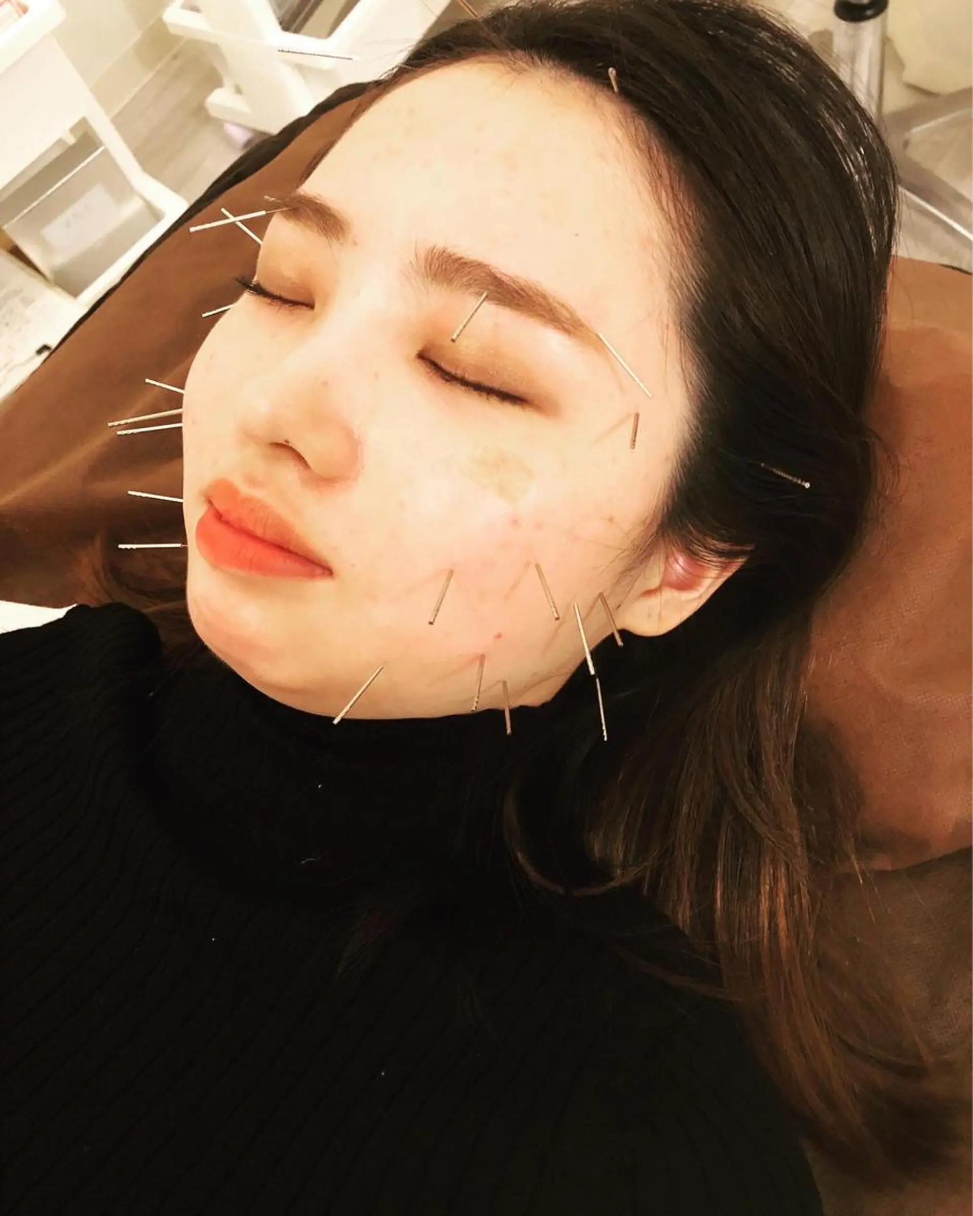 水島 秀輝（美容鍼灸師）のその他イメージ