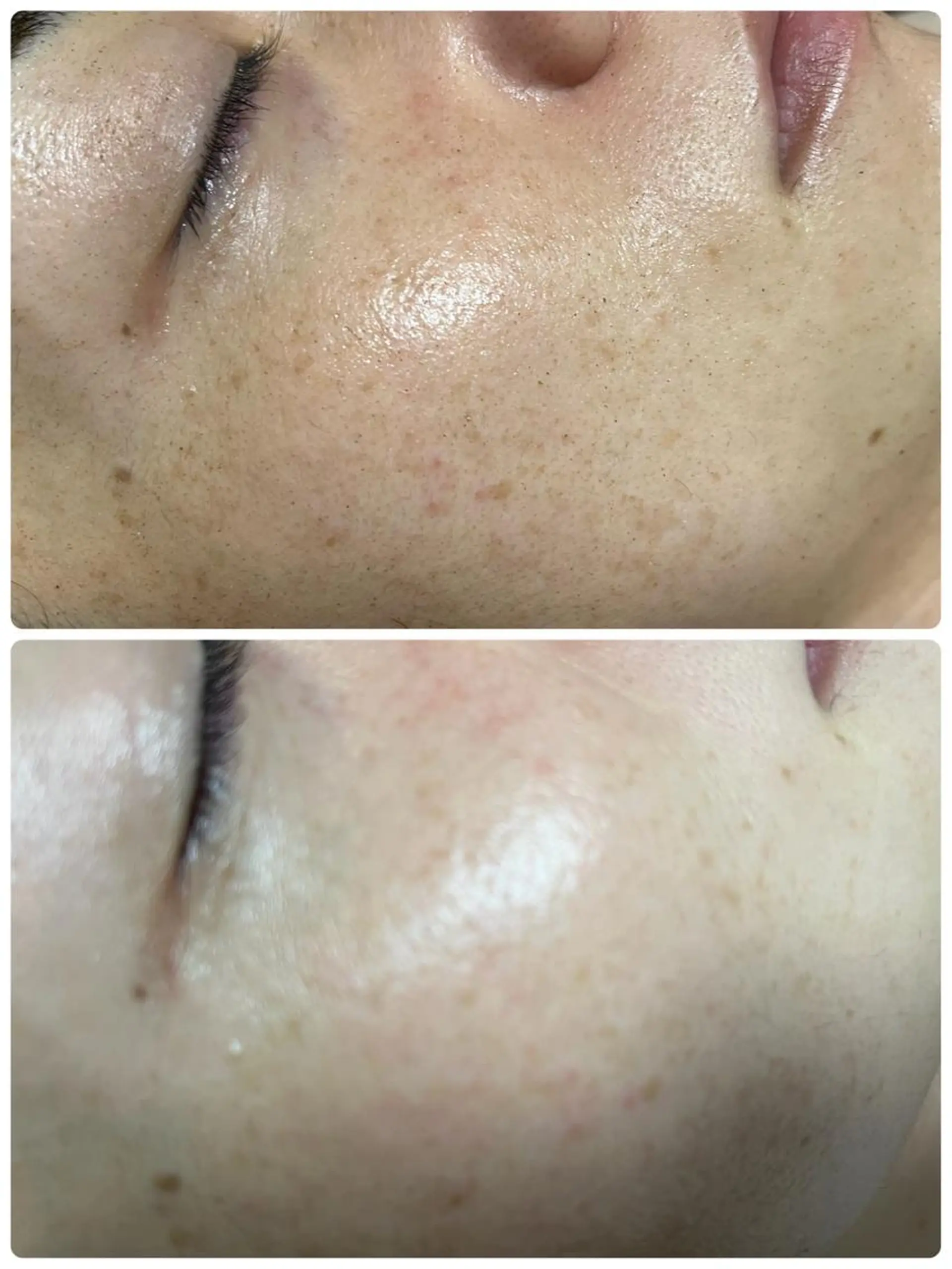 SALON BioBioのエステ・リラクイメージ