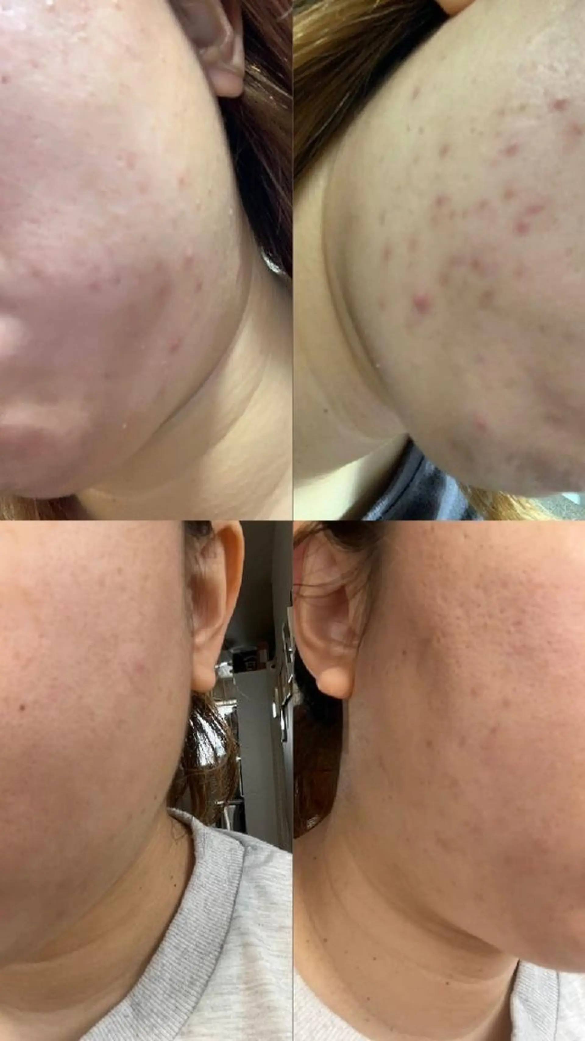 メナードフェイシャルサロン深井清水店所属・吉田 茜のエステ・リラクイメージ