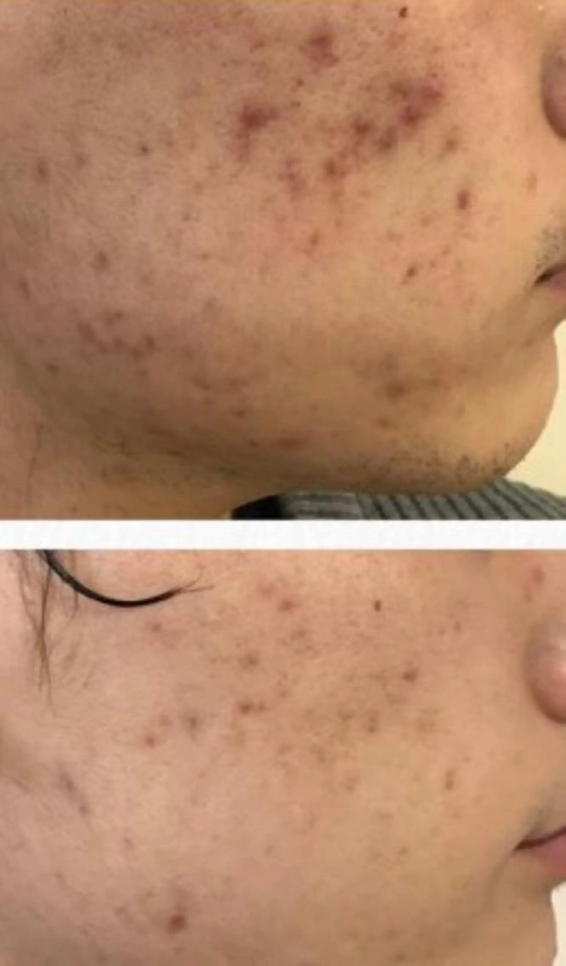 朝重い人専用 肩甲骨調整のエステ・リラクイメージ