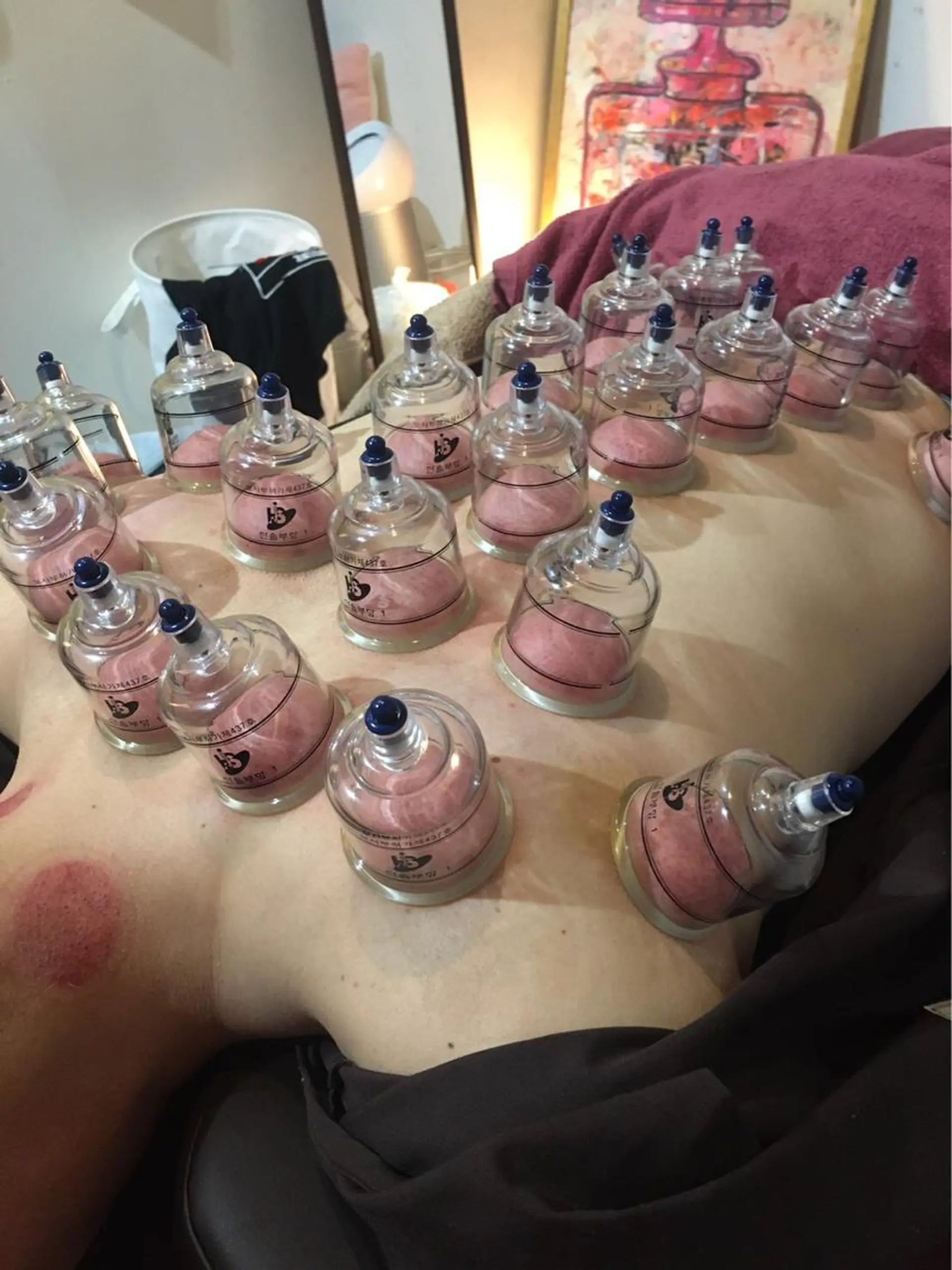 その他 美容鍼灸女性専用 りんご鍼灸治療院のその他イメージ