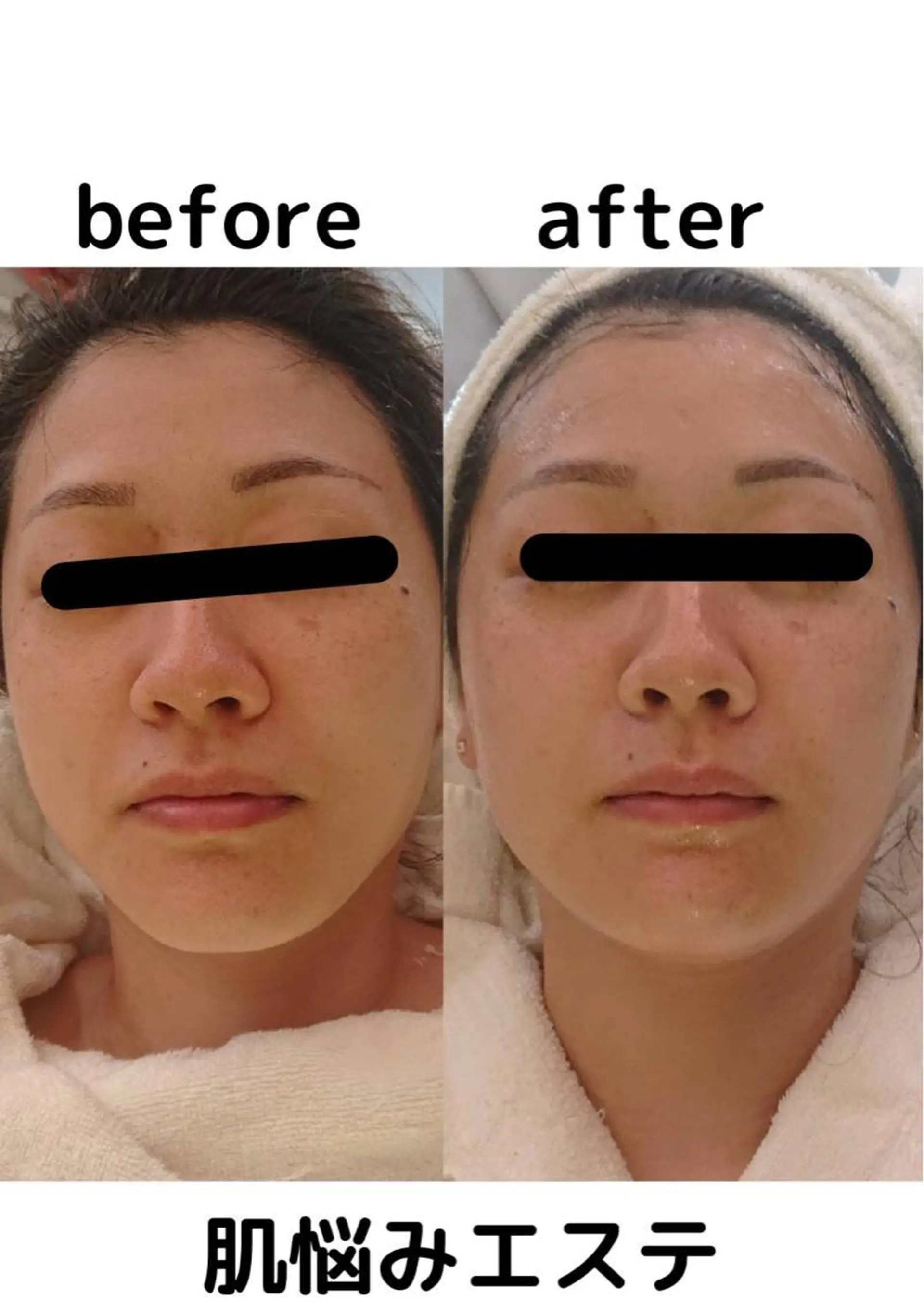 エステ リラク OTOHA よしだのエステ・リラクイメージ