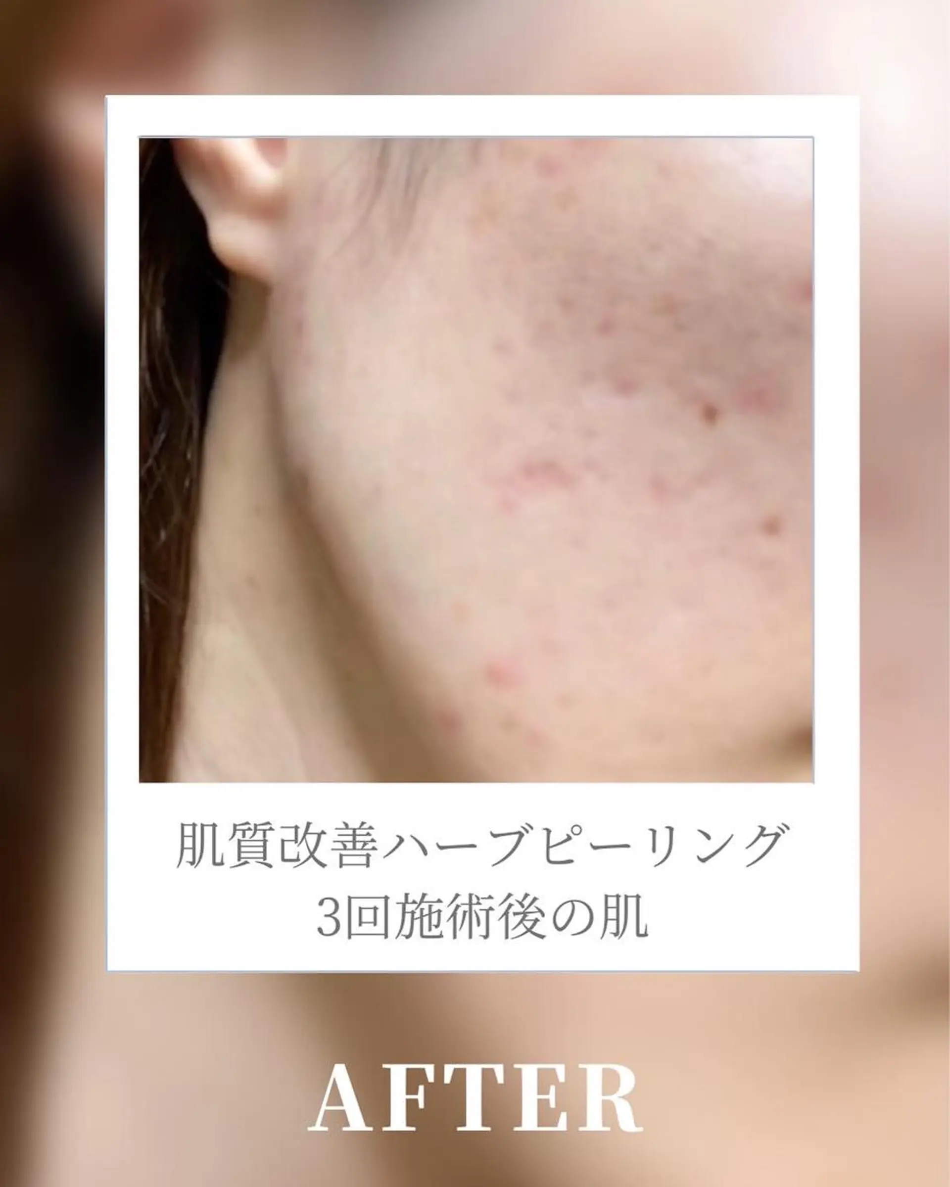 🎀BiBi韓国美容 コスパ強！美活サロンのエステ・リラクイメージ