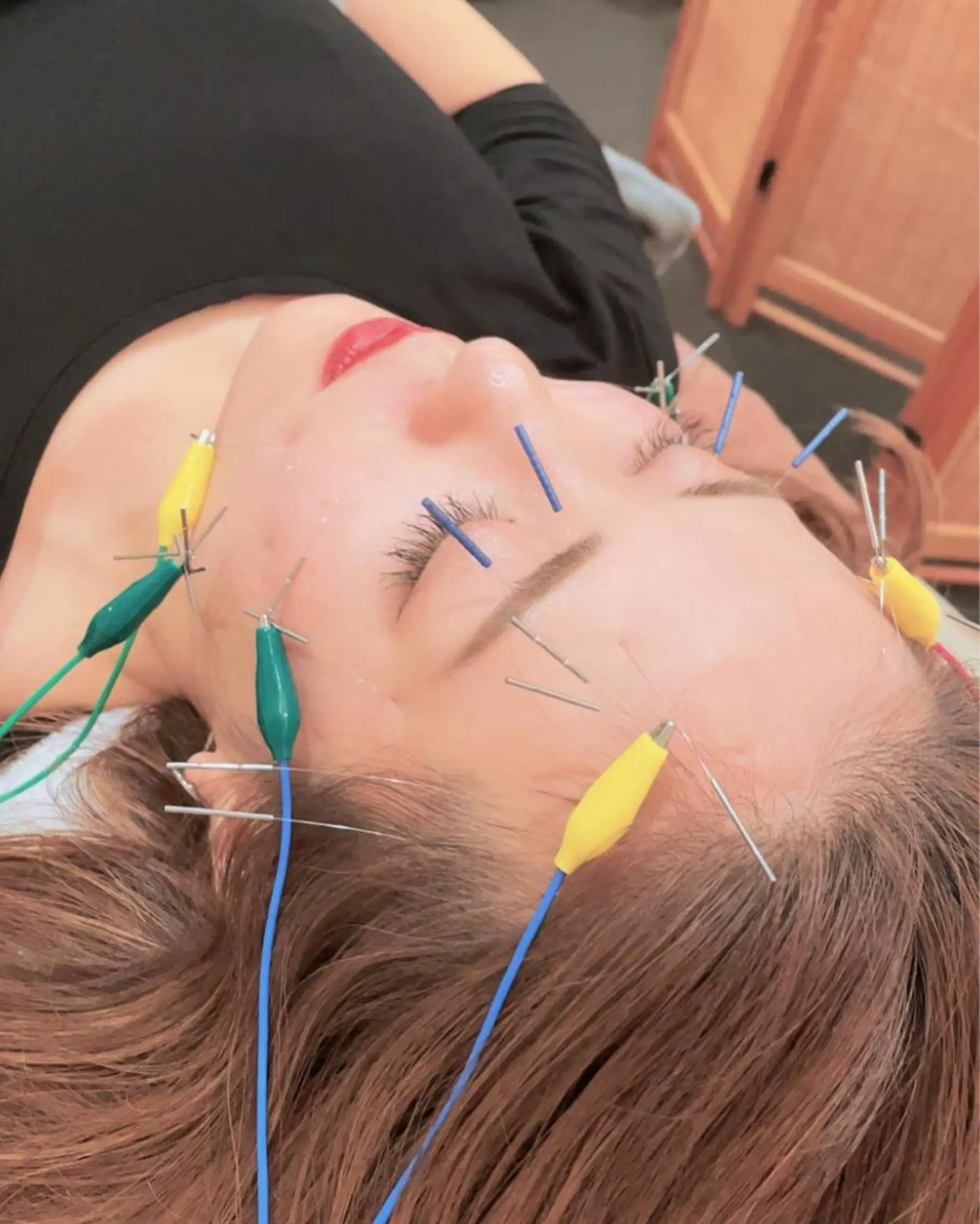 美容鍼・鍼灸専門❤✨ 近藤めぐみのエステ・リラクイメージ