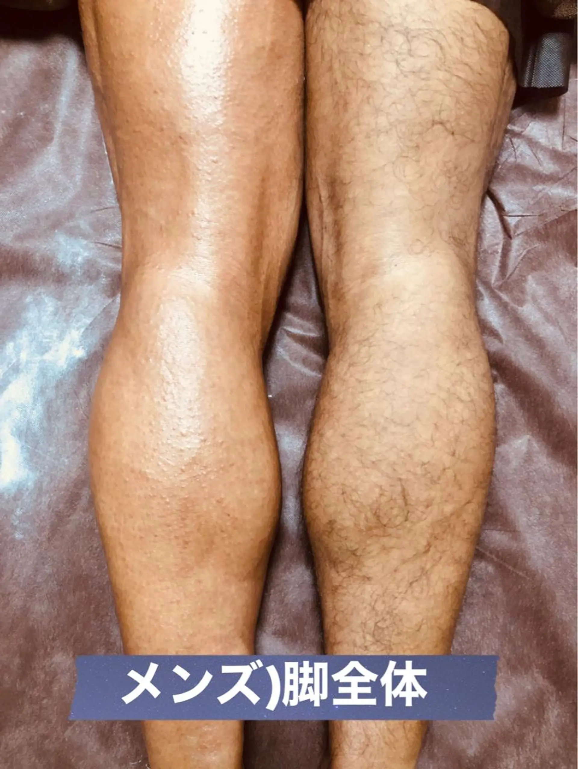 メンズ 脱毛 ブラジリアン☆WAX 🎖🌚YUKI🌚のエステ・リラクイメージ