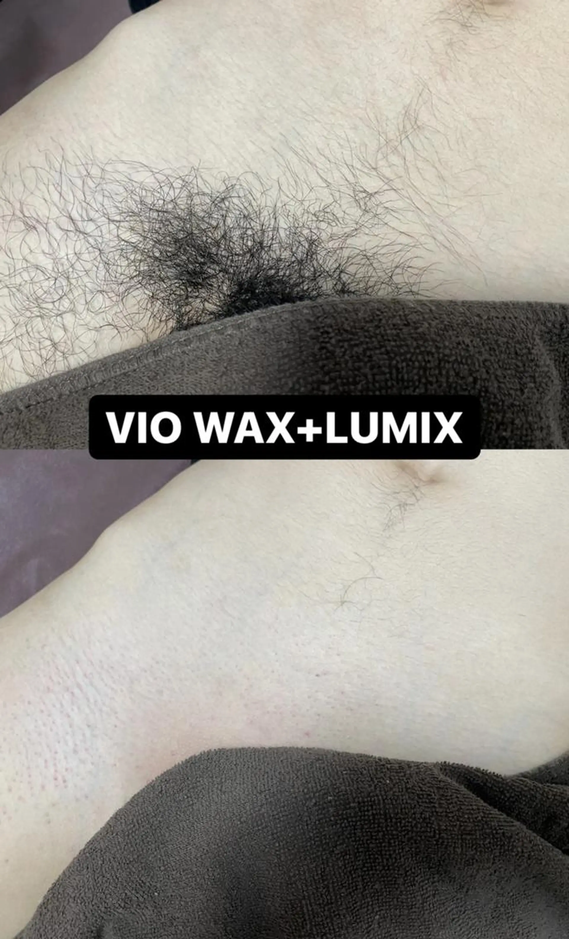 キッズ メンズ 脱毛 Epina 千葉店 【エピナ】のエステ・リラクイメージ