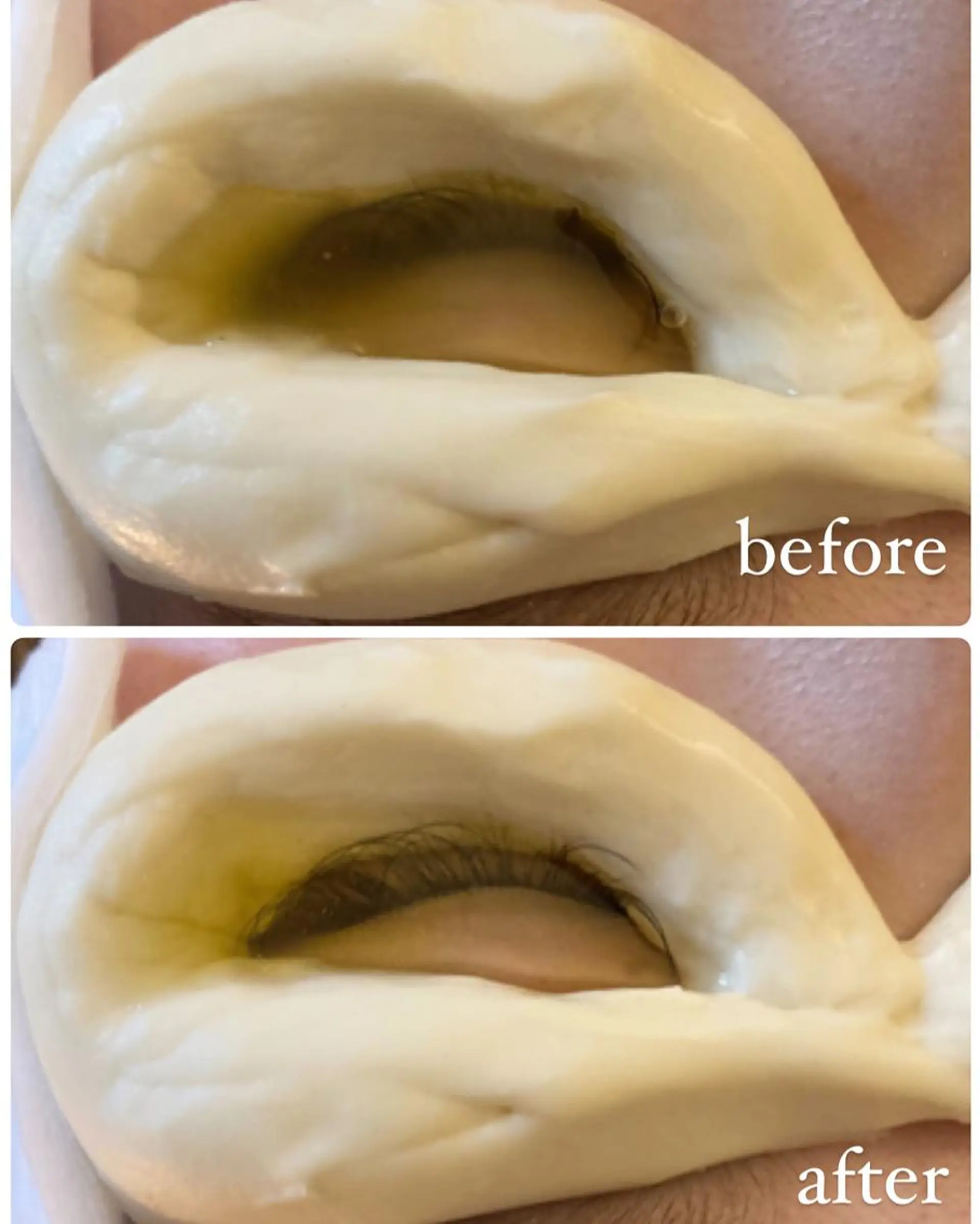 Rene 慢性疲労ケアサロンのエステ・リラクイメージ