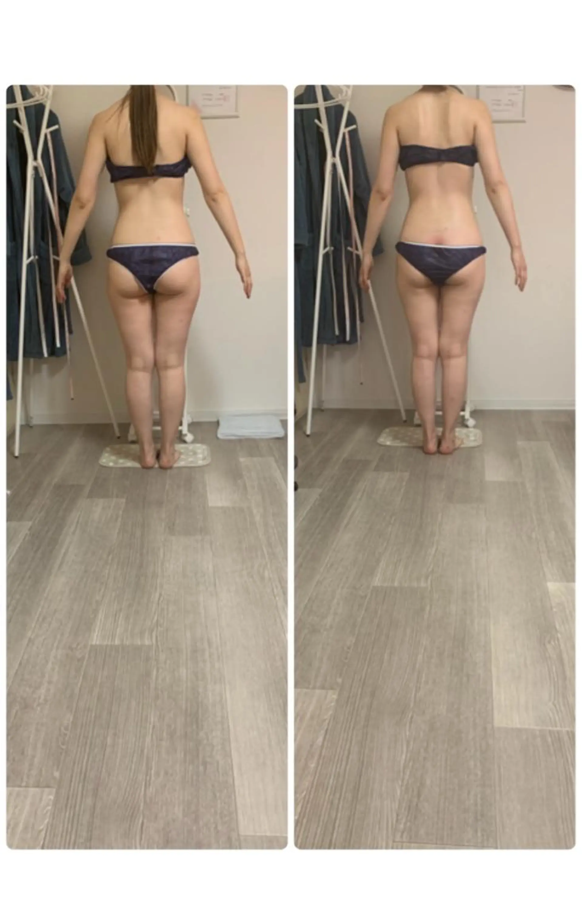 所沢 痩身エステサロンのエステ・リラクイメージ