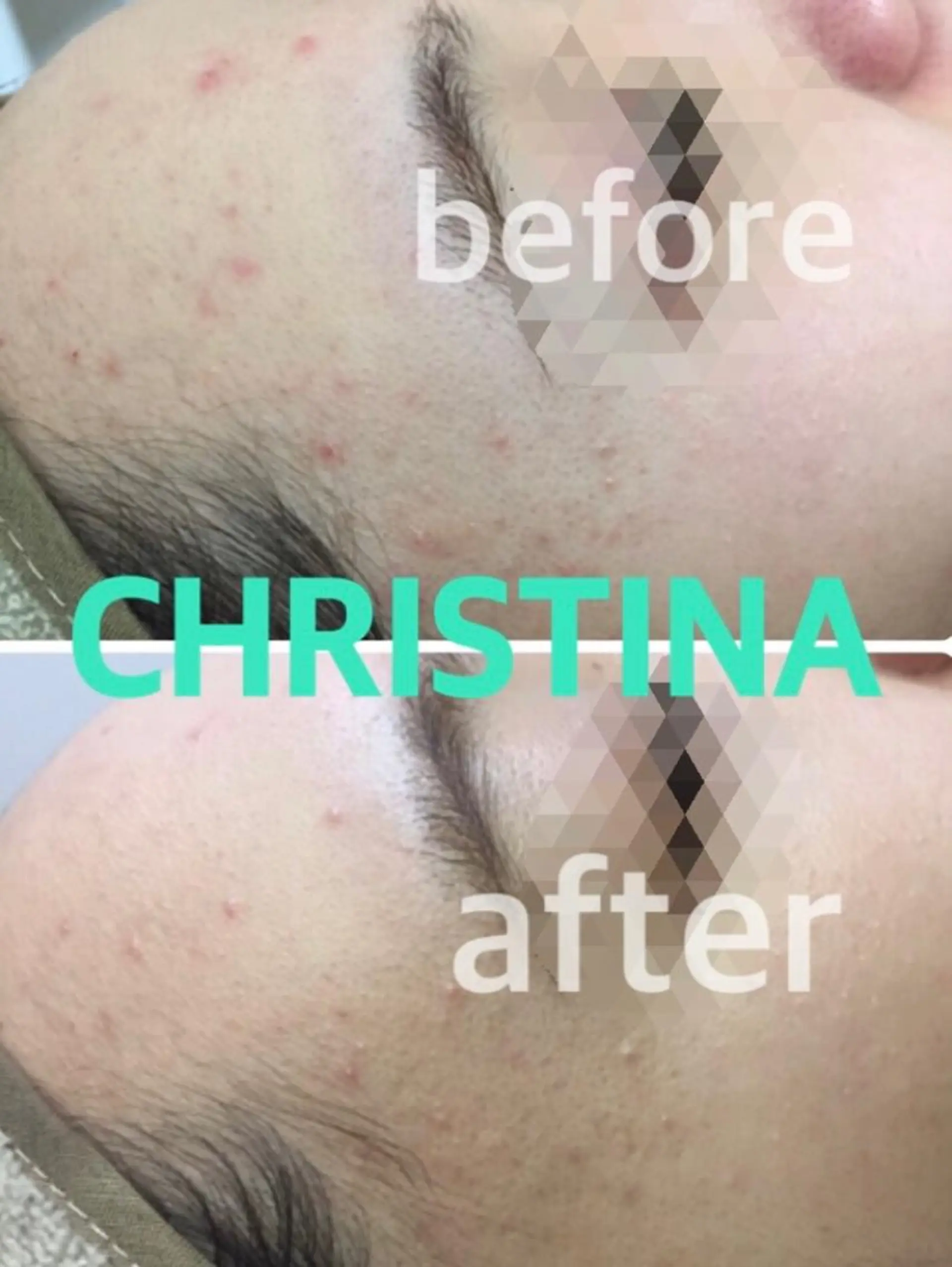 肌質改善サロン chouchouのエステ・リラクイメージ