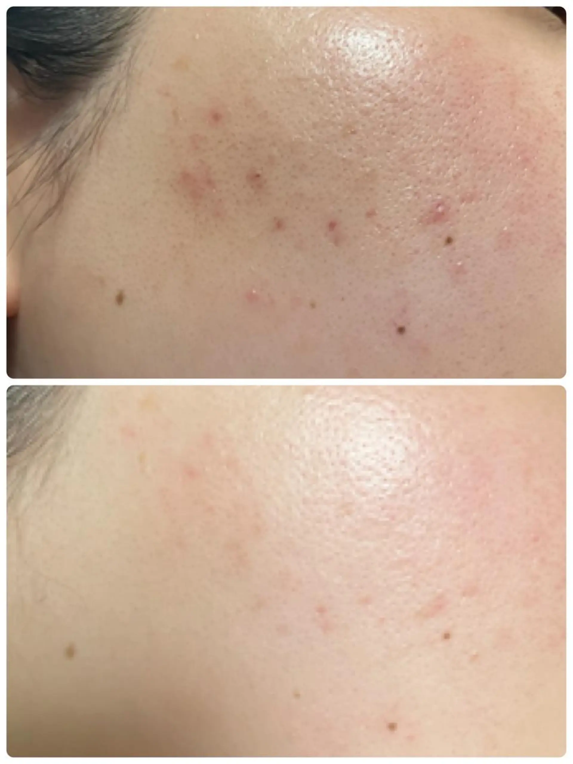 エステ リラク メナード片町 やまもと みくのエステ・リラクイメージ