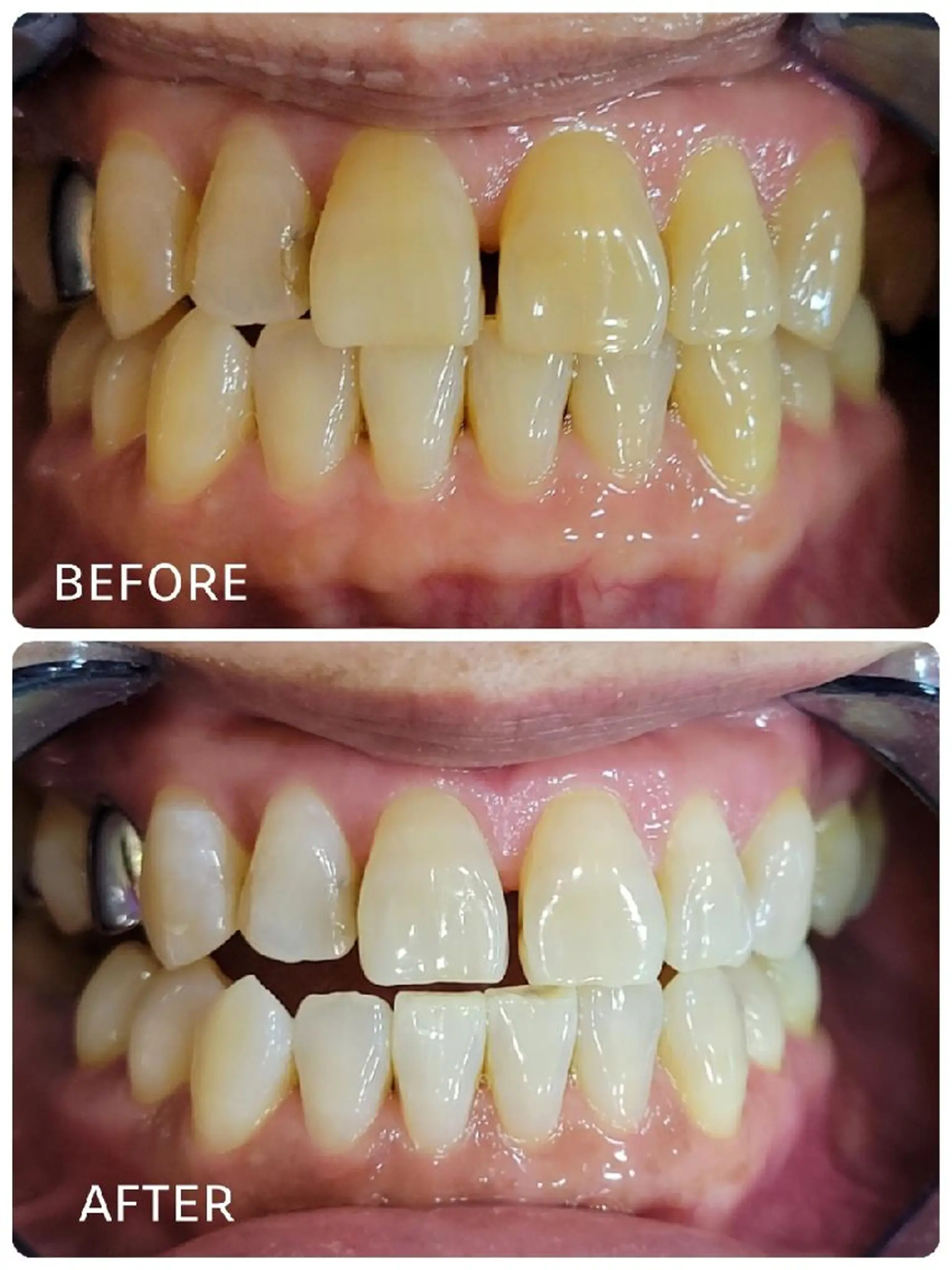 ホワイトニングサロン ラウレアのその他イメージ