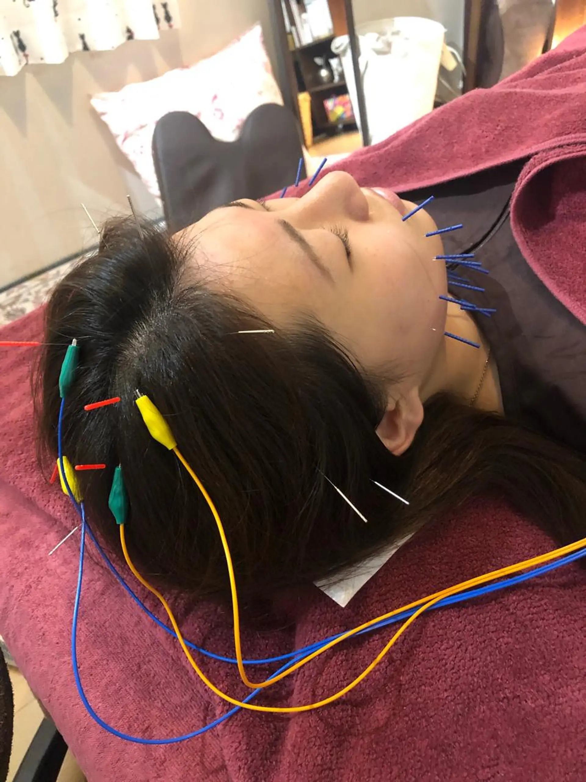 エステ リラク 美容鍼灸女性専用 りんご鍼灸治療院のその他イメージ