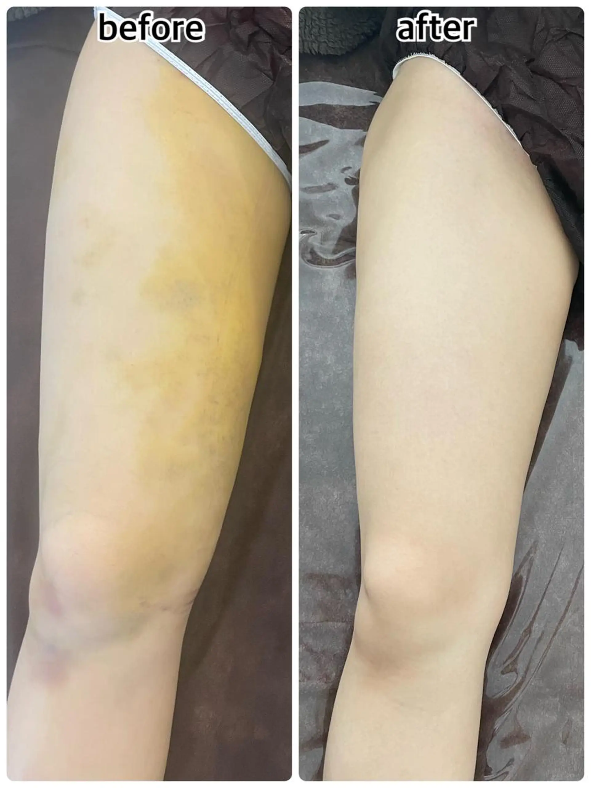 💎 GEM💎のエステ・リラクイメージ