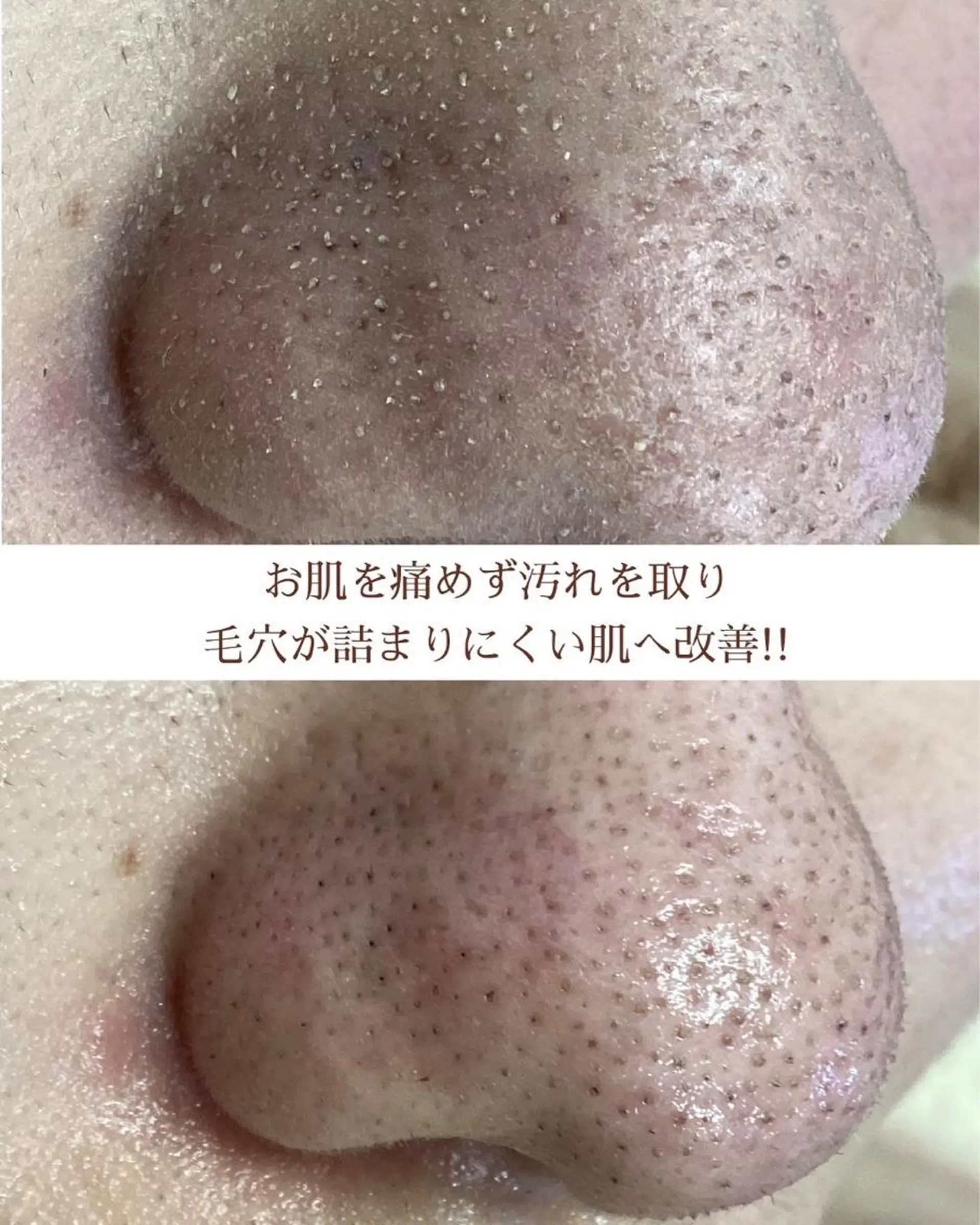 都度払い 肌質改善専門サロンのエステ・リラクイメージ