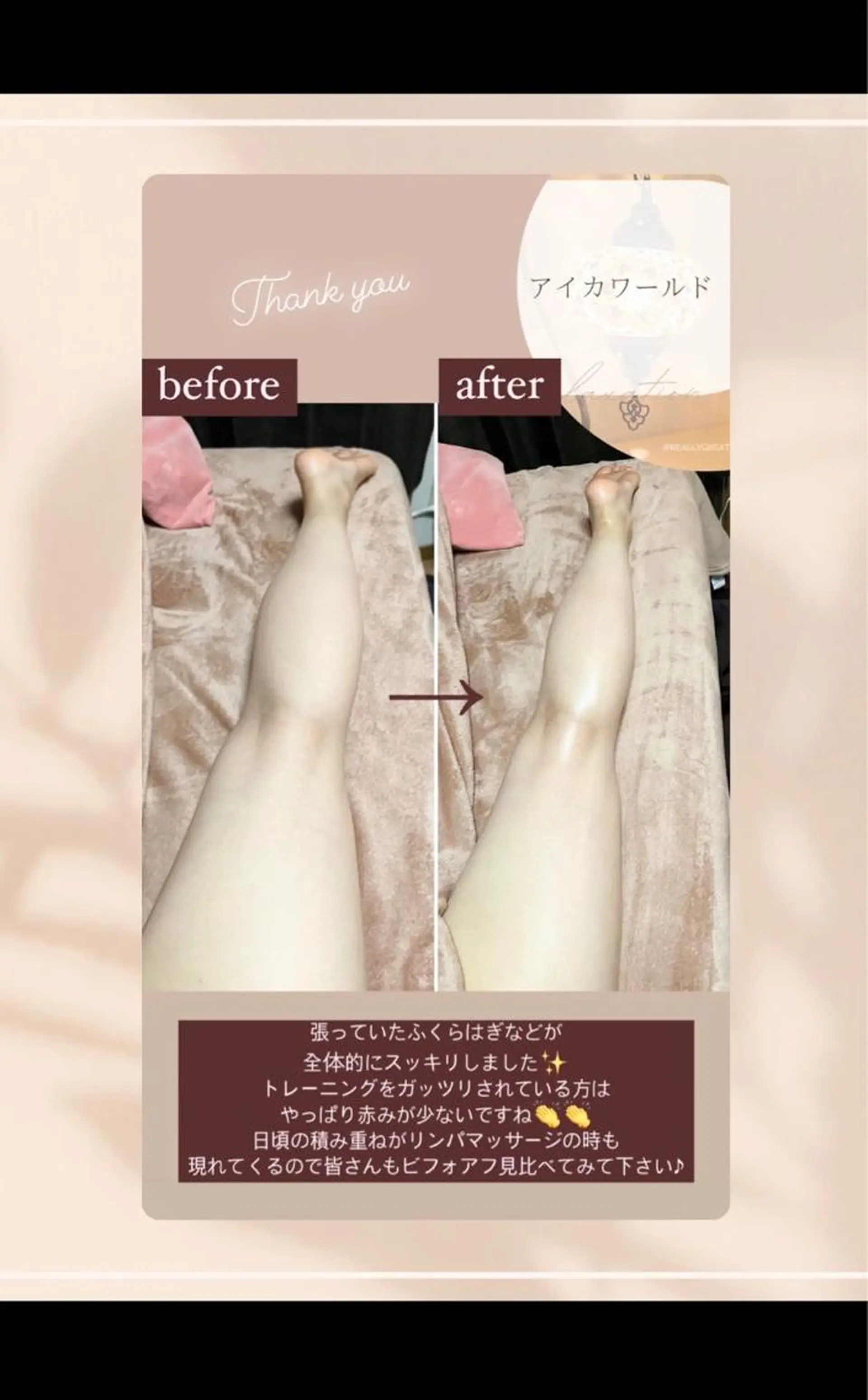 アイカワールド所属・鈴木 愛加のエステ・リラクイメージ