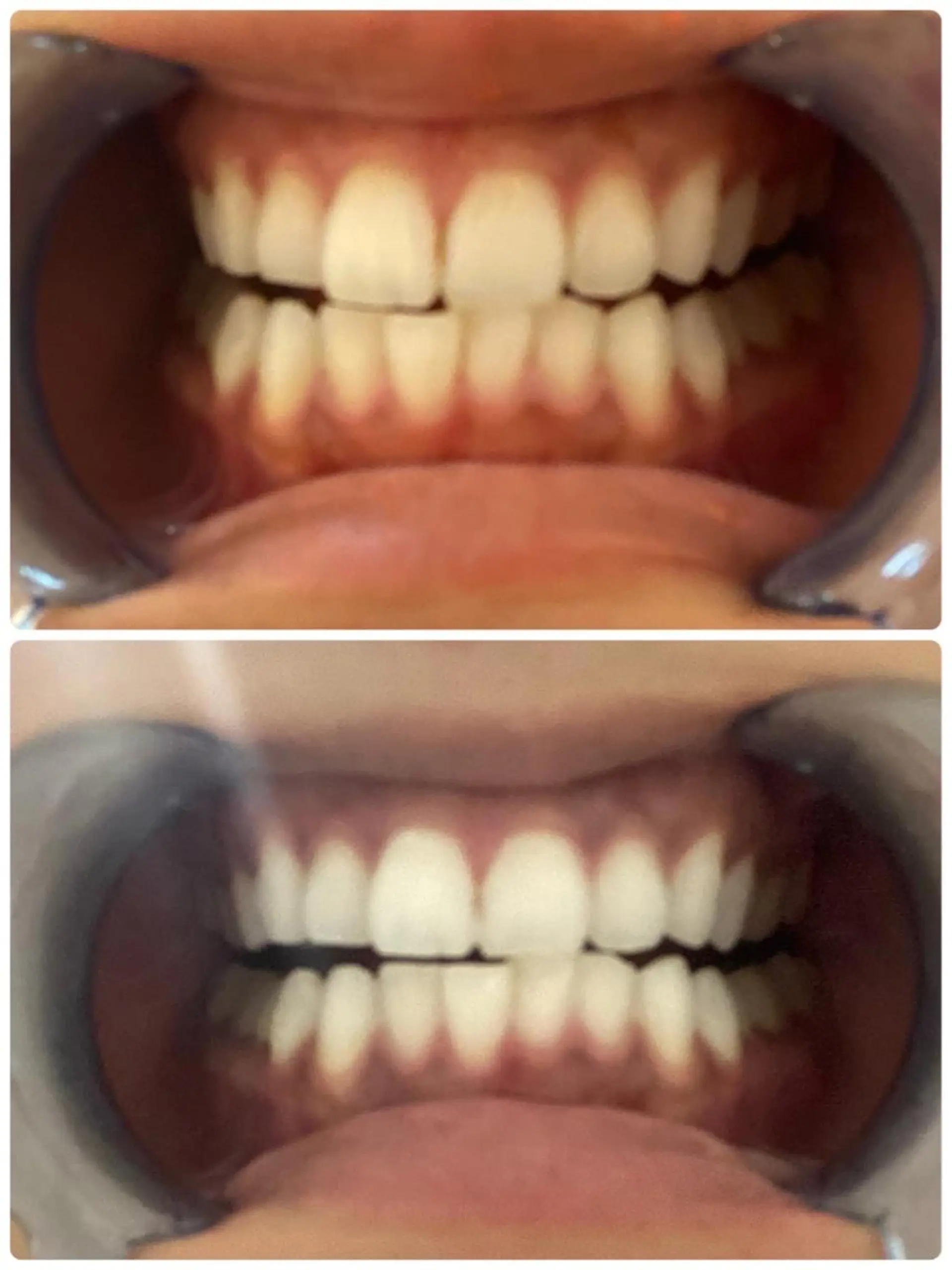 その他 ホワイトニングジム 池袋のその他イメージ