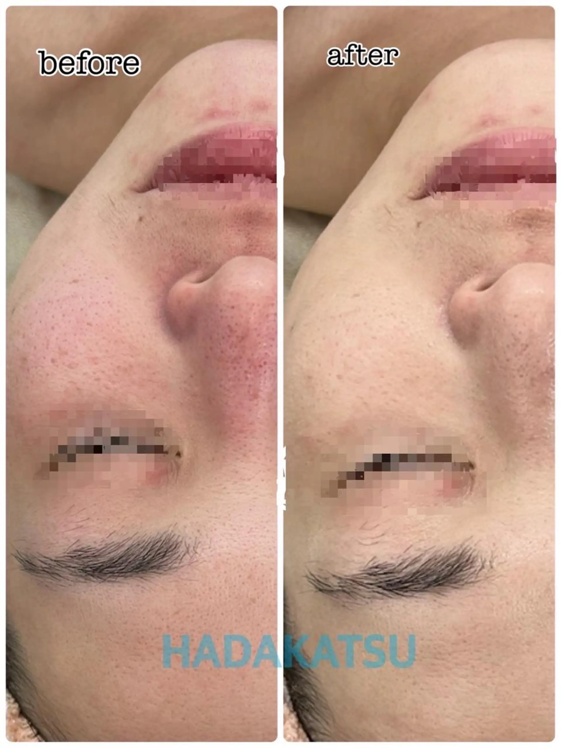 エステ 総合エステサロン 肌活のエステ・リラクイメージ