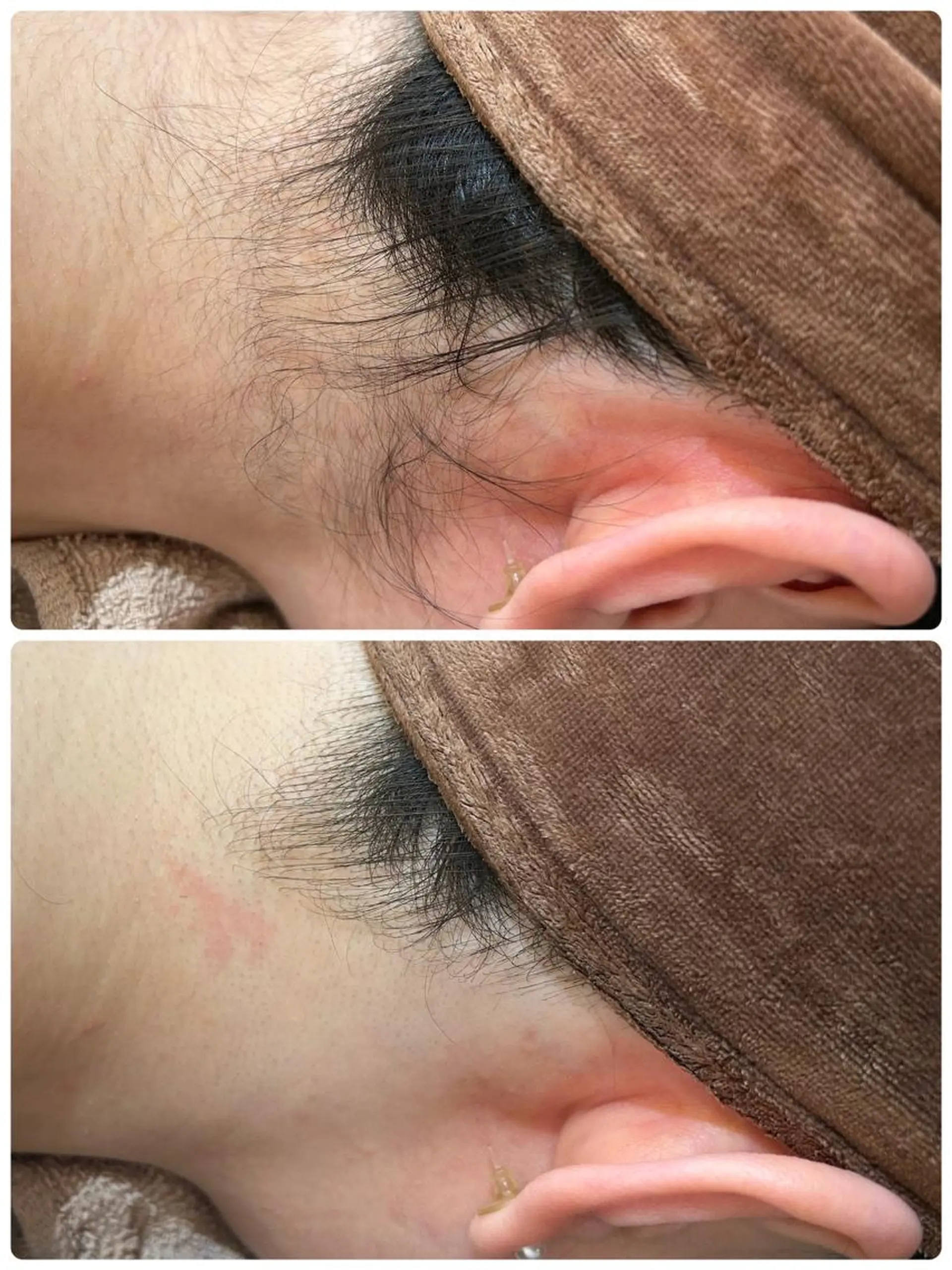 脱毛 👑Linola👑 レイビス　纐纈のエステ・リラクイメージ