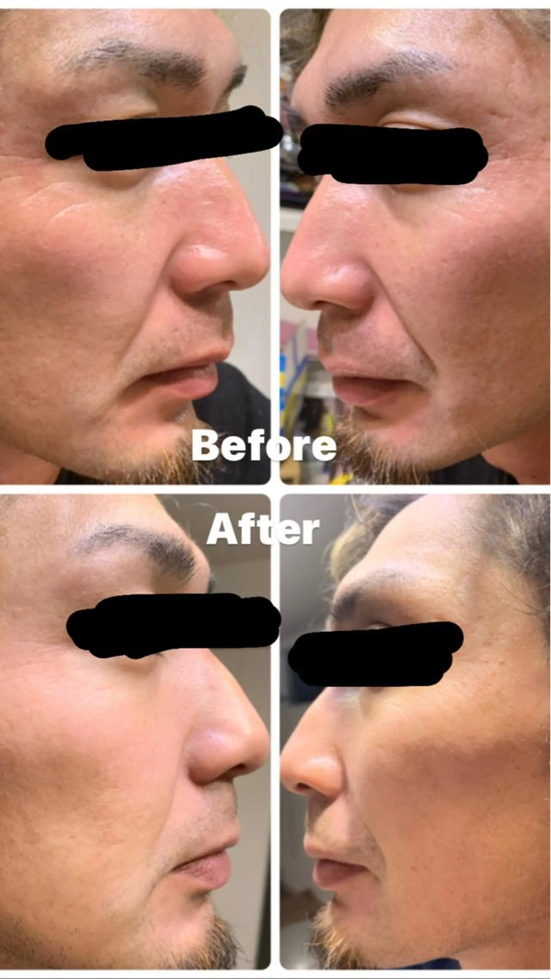 eyelist Asamiのマツエク・マツパデザイン