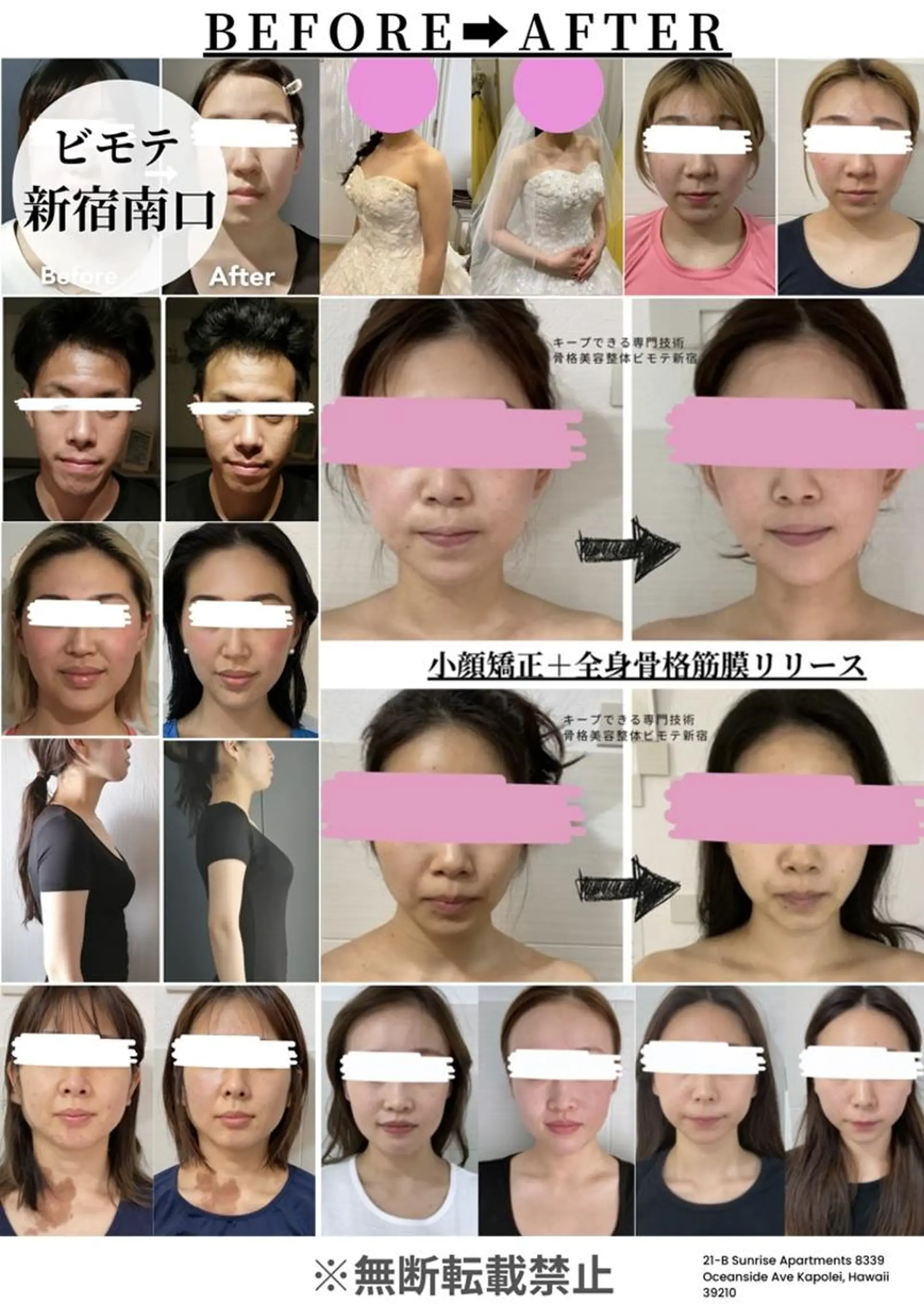 骨格美容整体 bimote.新宿のエステ・リラクイメージ