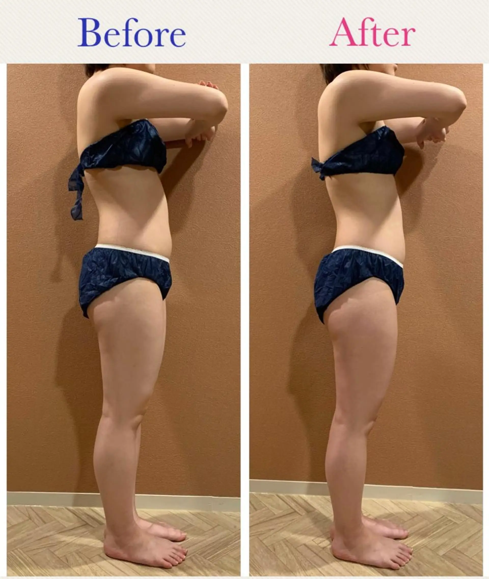 Rewhite -リホワイト-のエステ・リラクイメージ