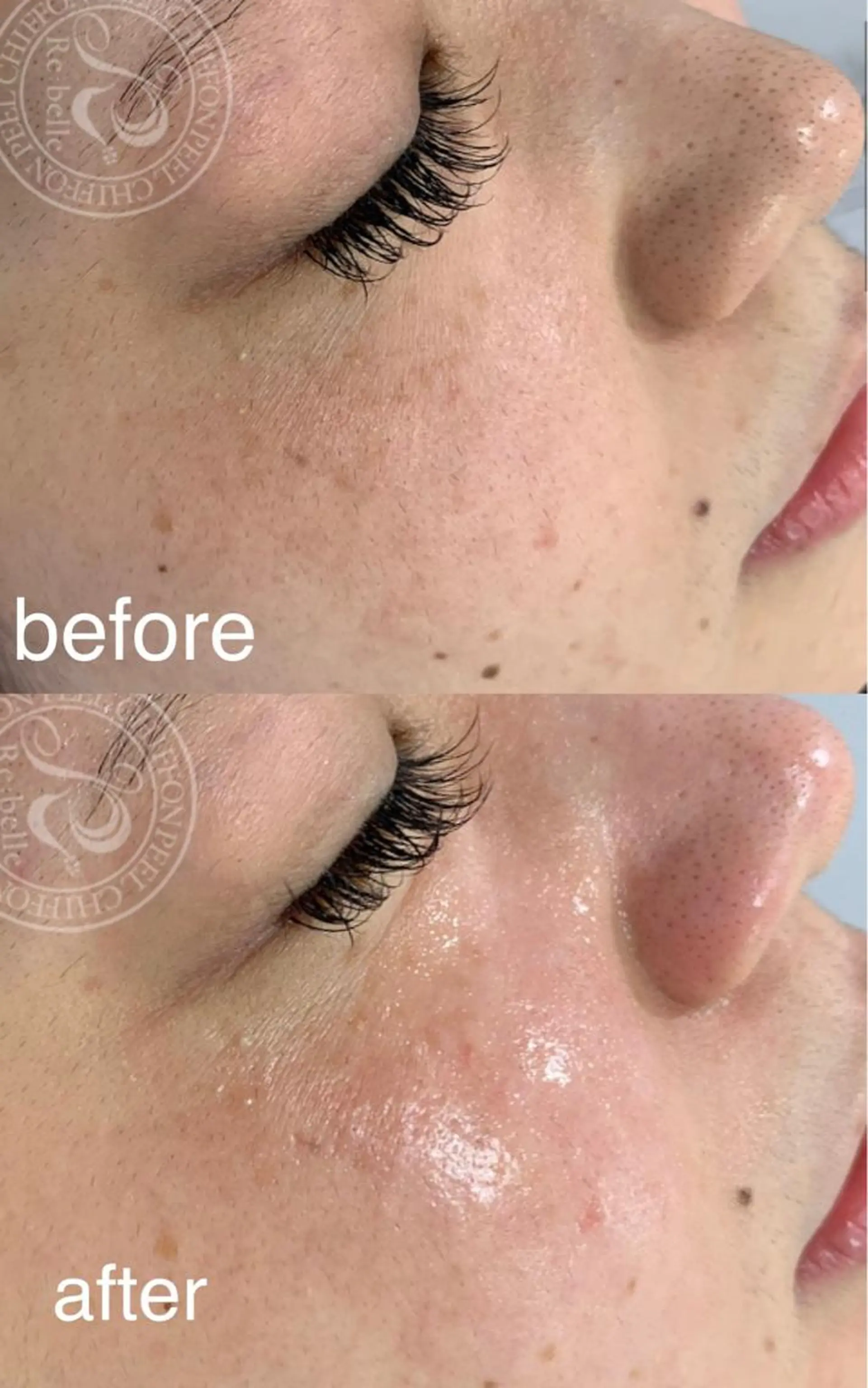 エステ Lavi&所属・肌質改善サロン Ｌａｖｉ＆のその他イメージ