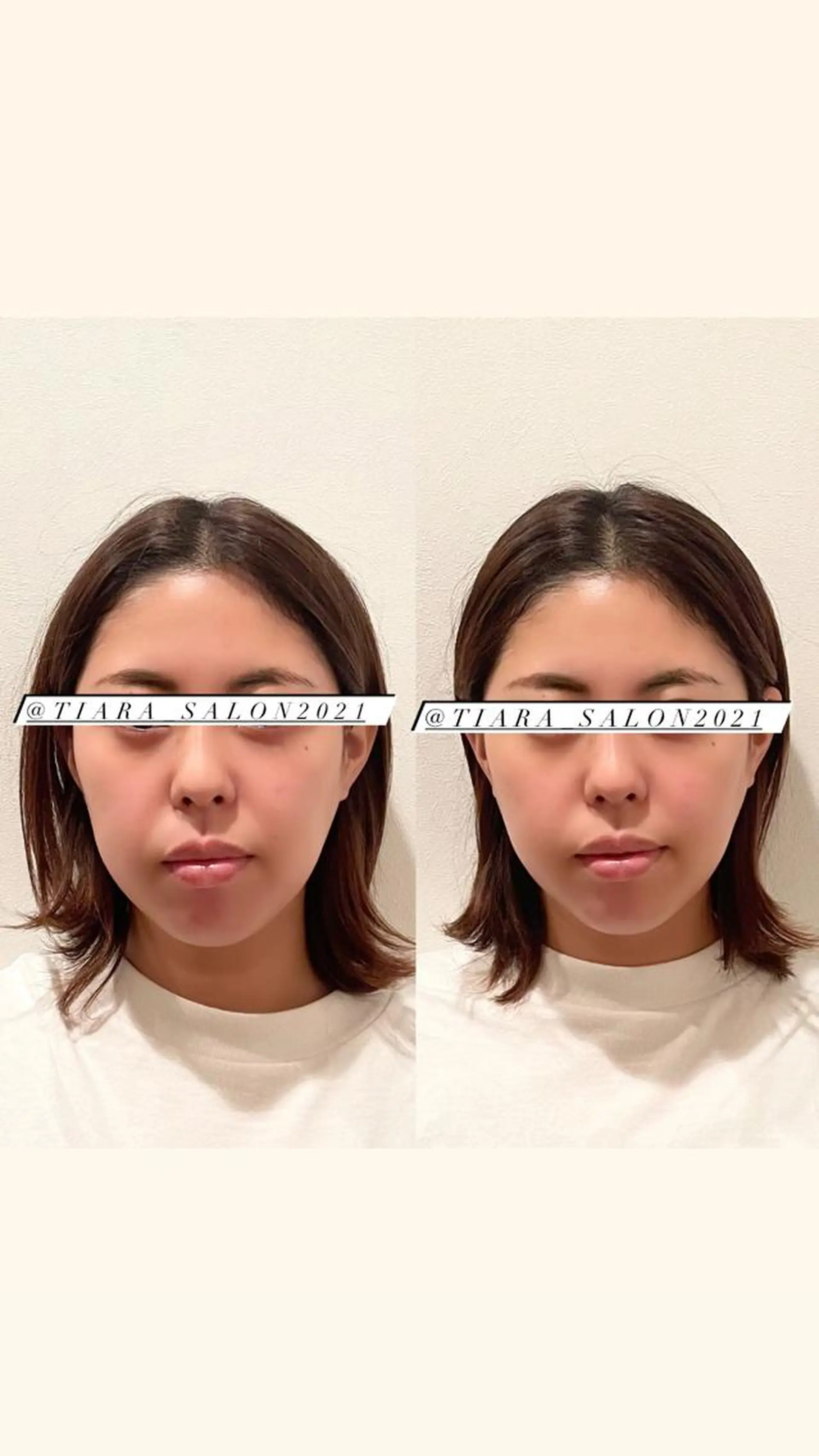 鍼灸サロン TIARA　美容鍼のエステ・リラクイメージ