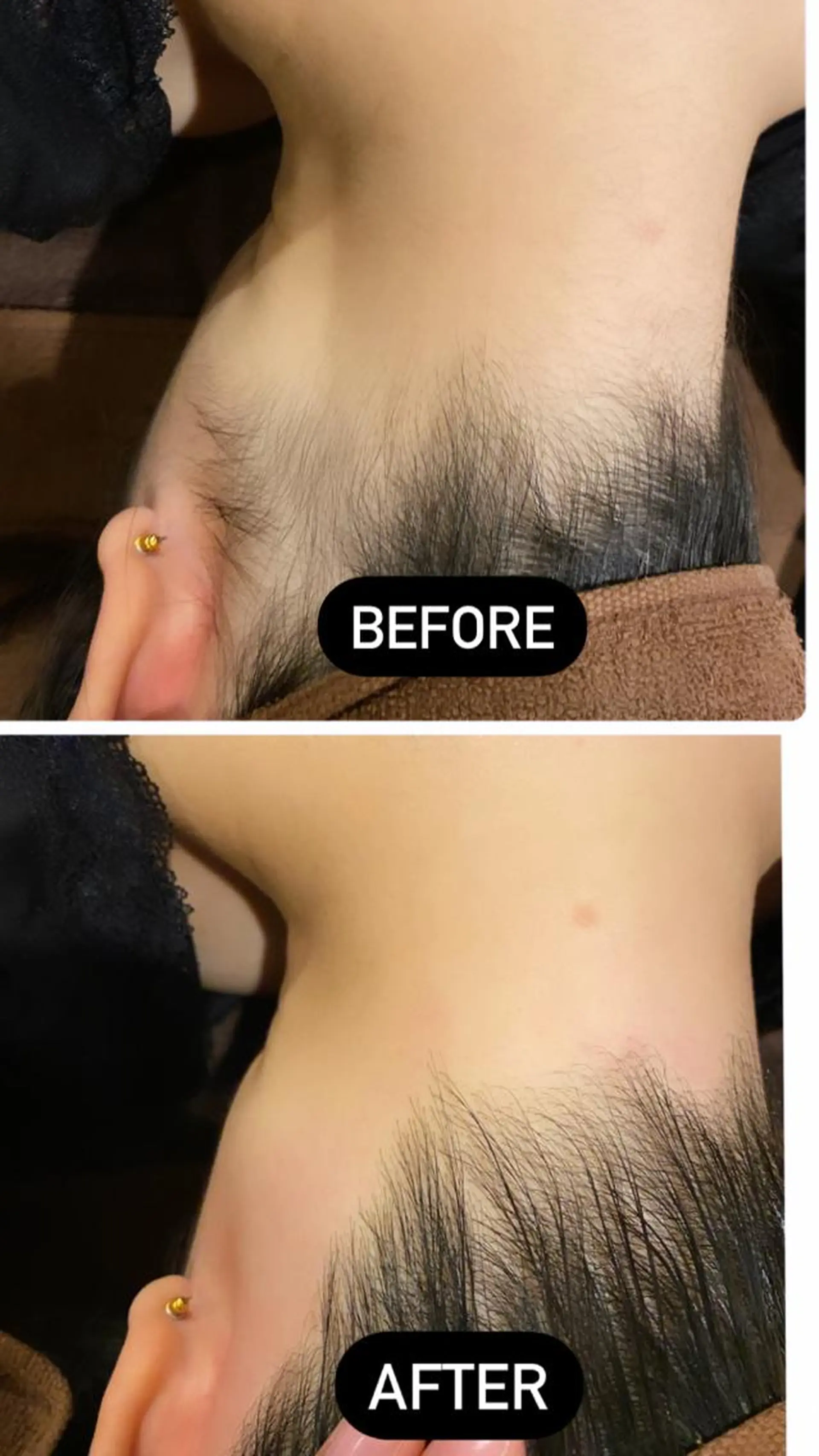 脱毛 北堀江サロン BIREINAのエステ・リラクイメージ