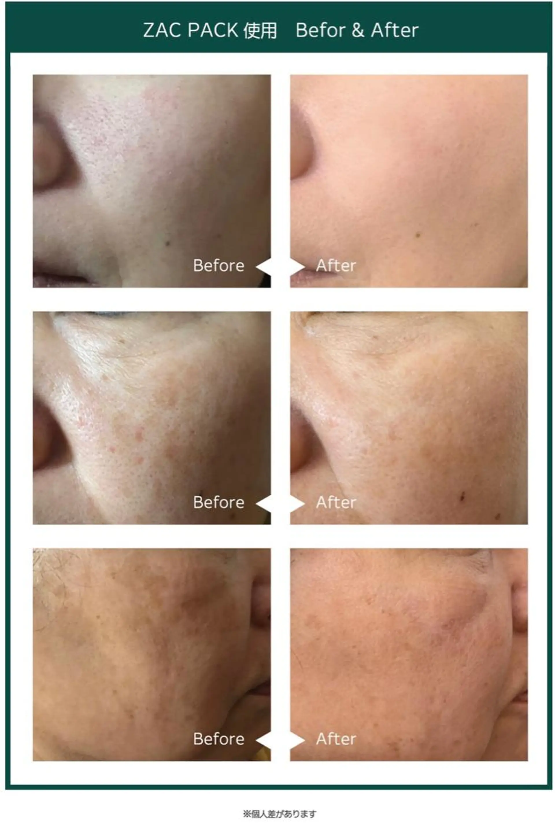 エステ Porte beauteオーナーのエステ・リラクイメージ