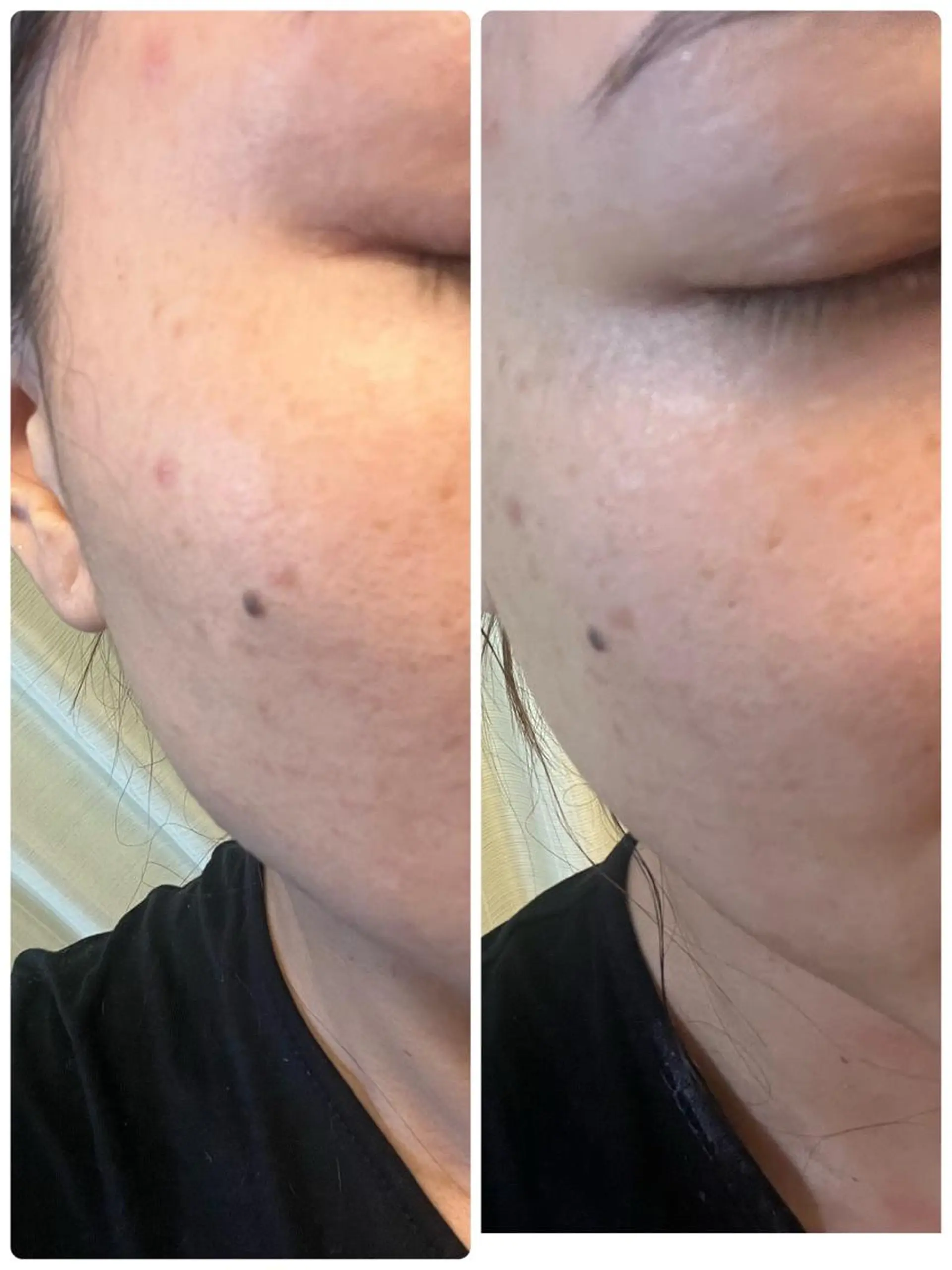 SALON BioBioのエステ・リラクイメージ