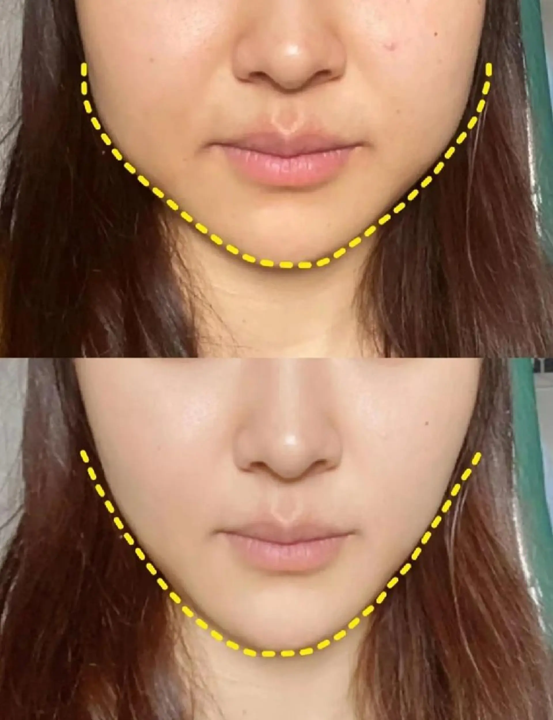 aliaハーブ水光店 エステティシャン募集のエステ・リラクイメージ