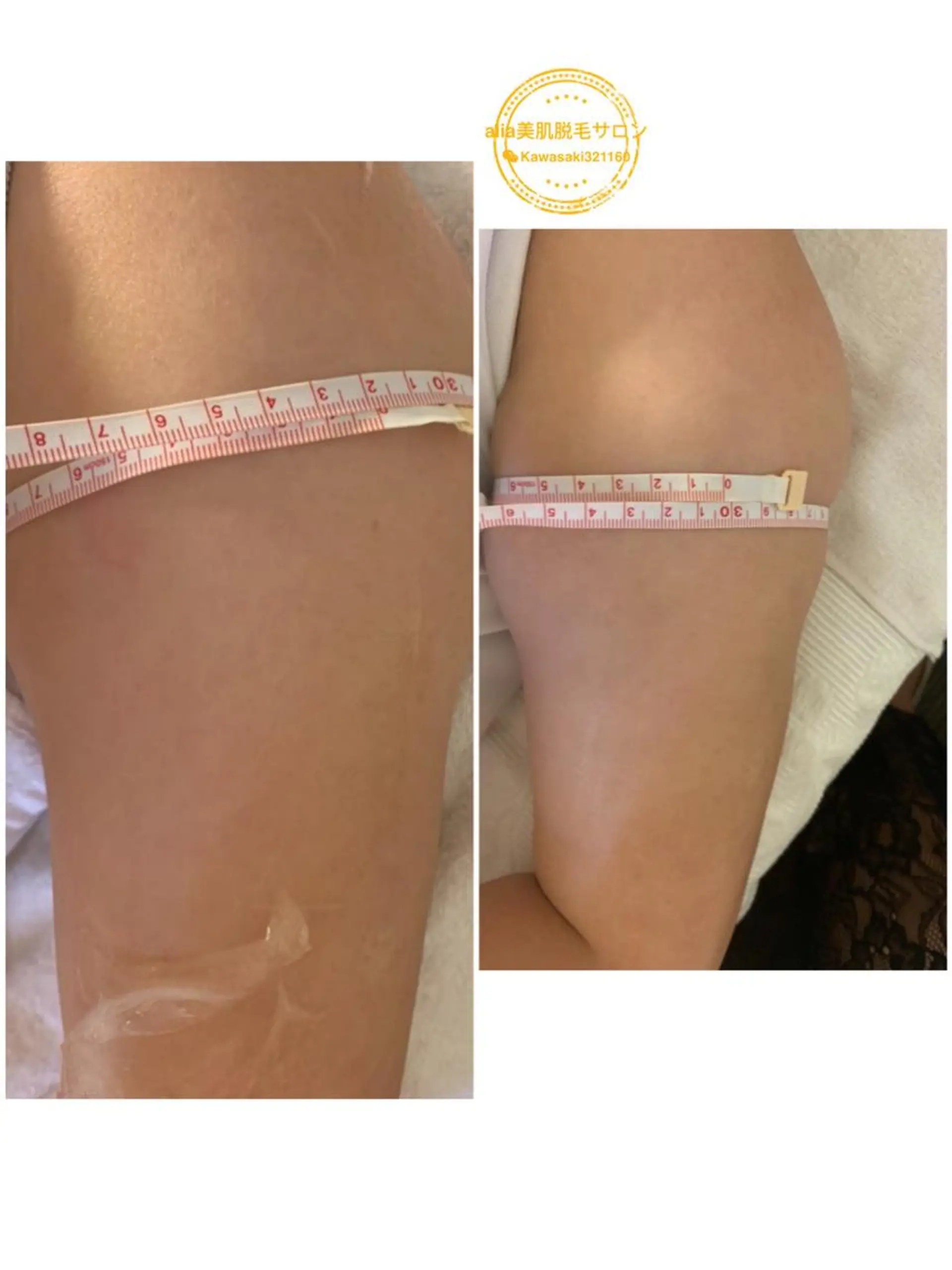 aliaハーブ水光店 エステティシャン募集のエステ・リラクイメージ