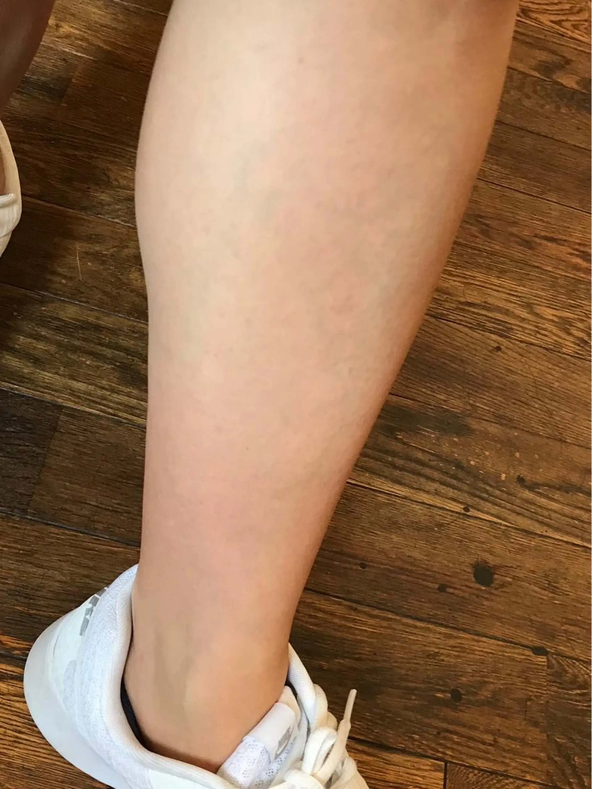 脱毛 カットスタジオスコール所属・田中 信子のエステ・リラクイメージ