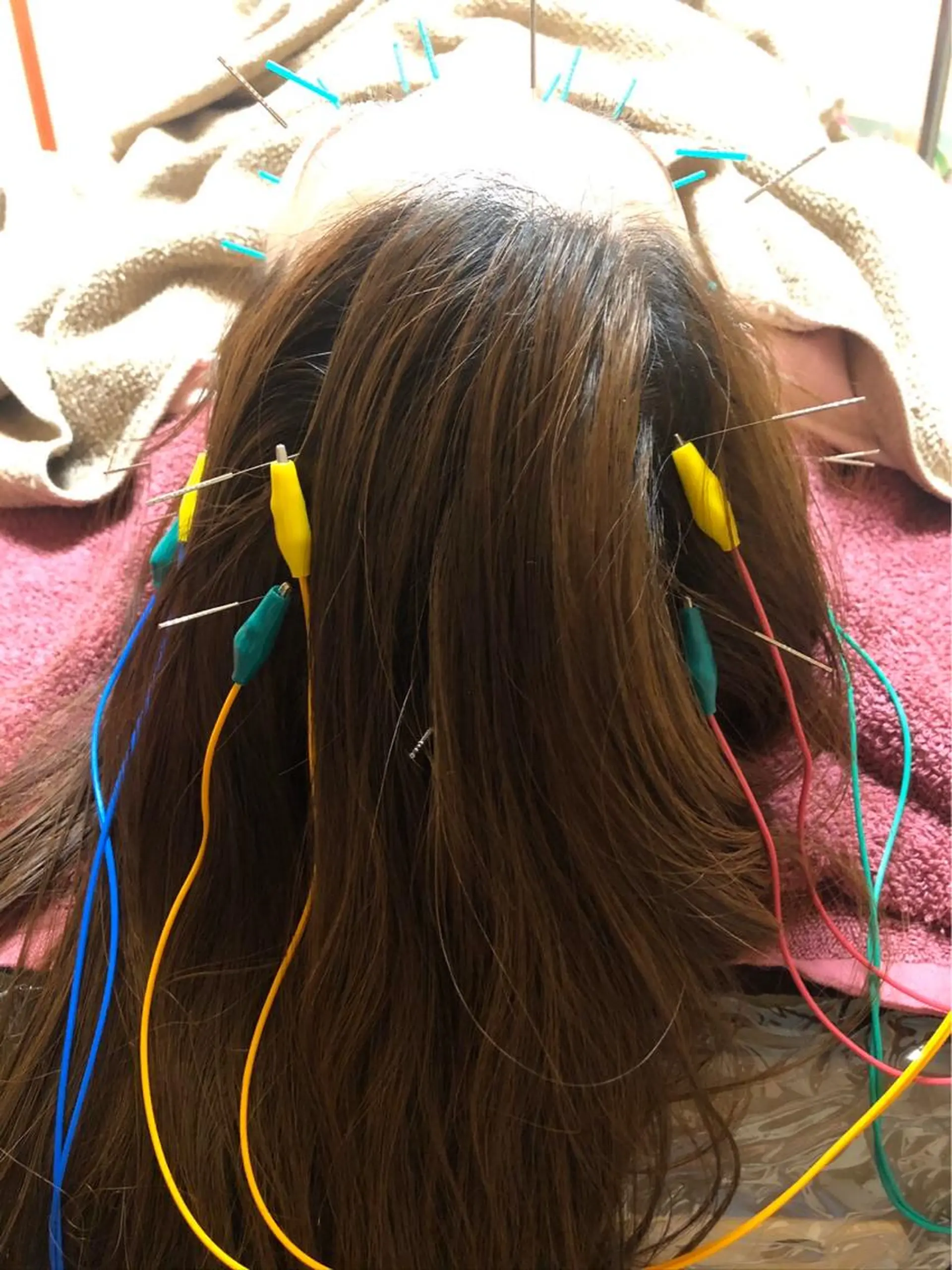 エステ リラク 美容鍼灸女性専用 りんご鍼灸治療院のその他イメージ