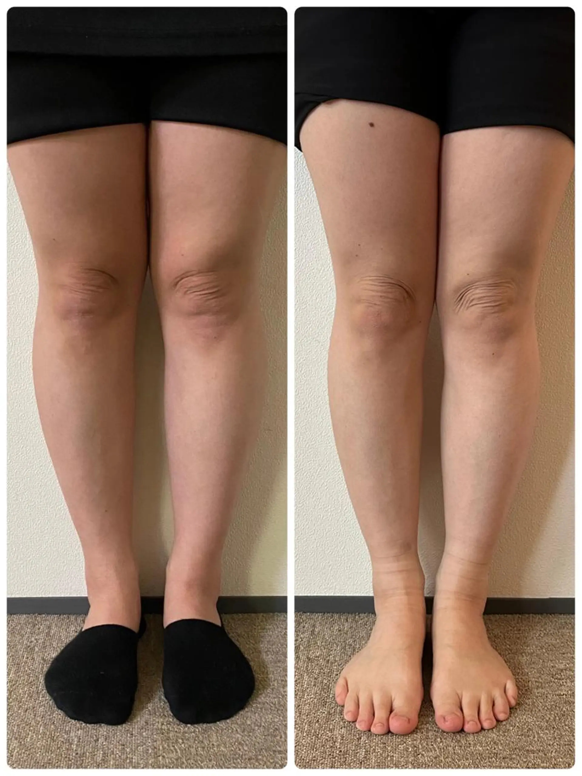 肩こり・首コリ 専門店Fuüのエステ・リラクイメージ