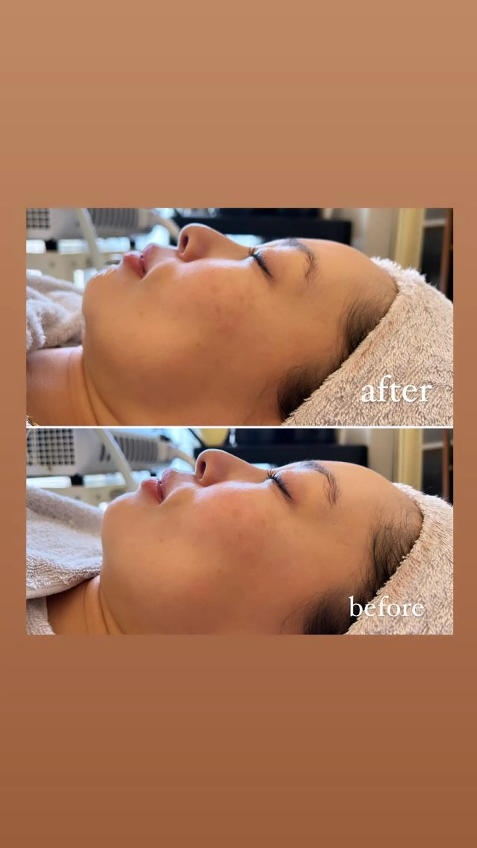 ワックス脱毛🌈 ESPOIRnocoのエステ・リラクイメージ