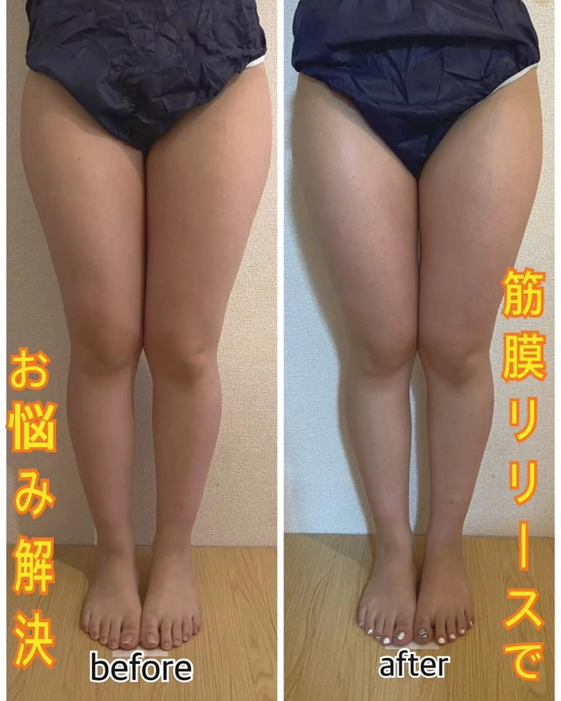 ❤︎MN❤︎ モンのエステ・リラクイメージ