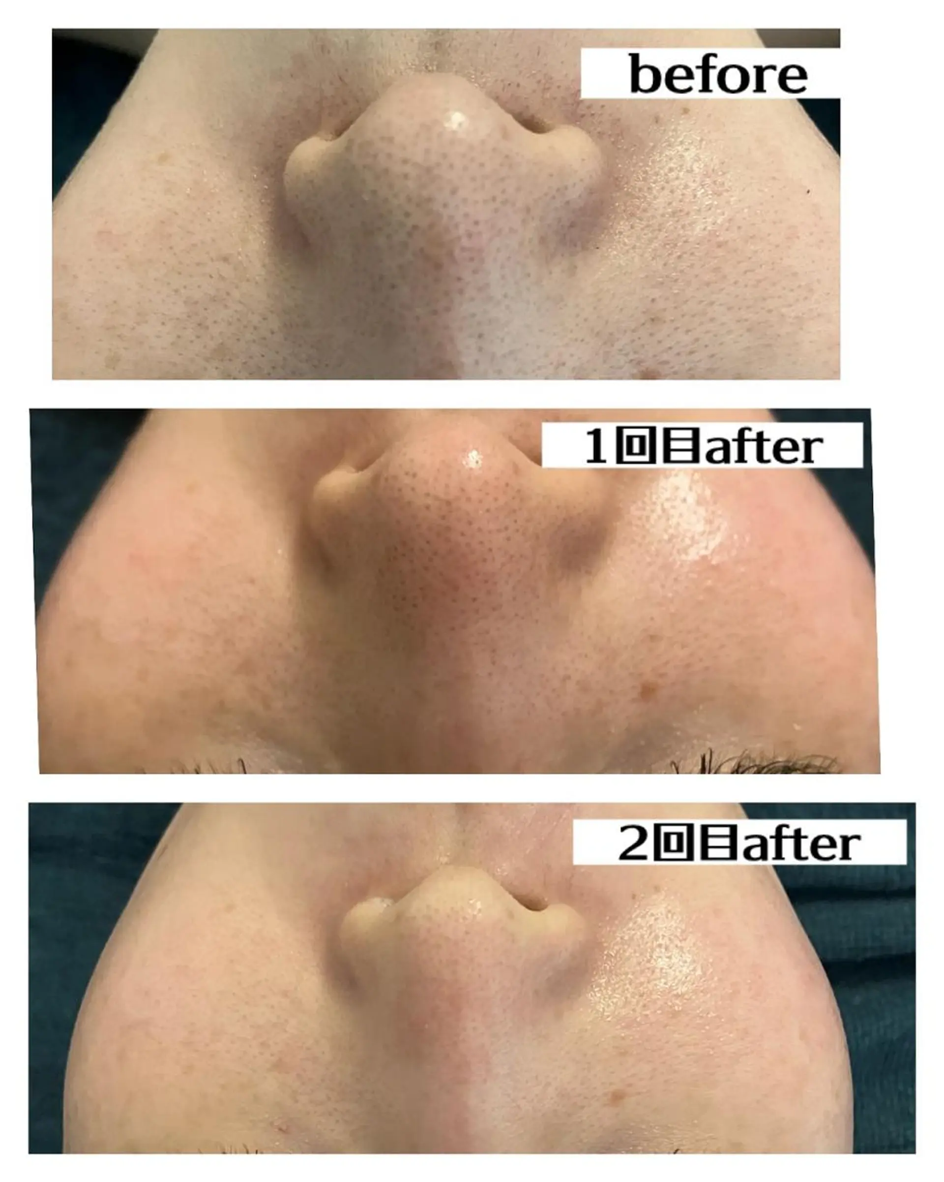 エステ Dione湘南藤沢店 ×LUANA　齋藤のエステ・リラクイメージ