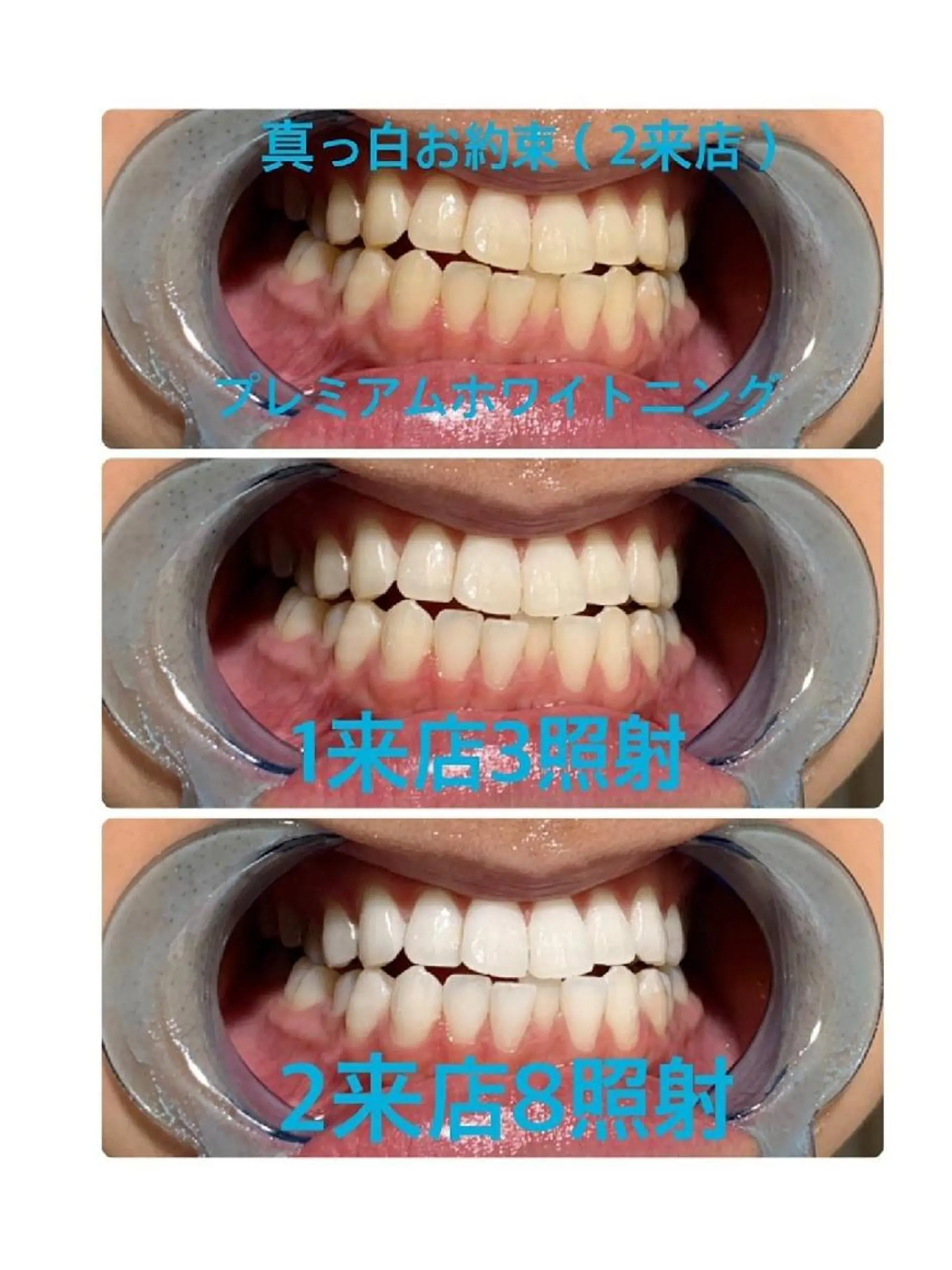 プラチナム ビューティー船橋本店のその他イメージ