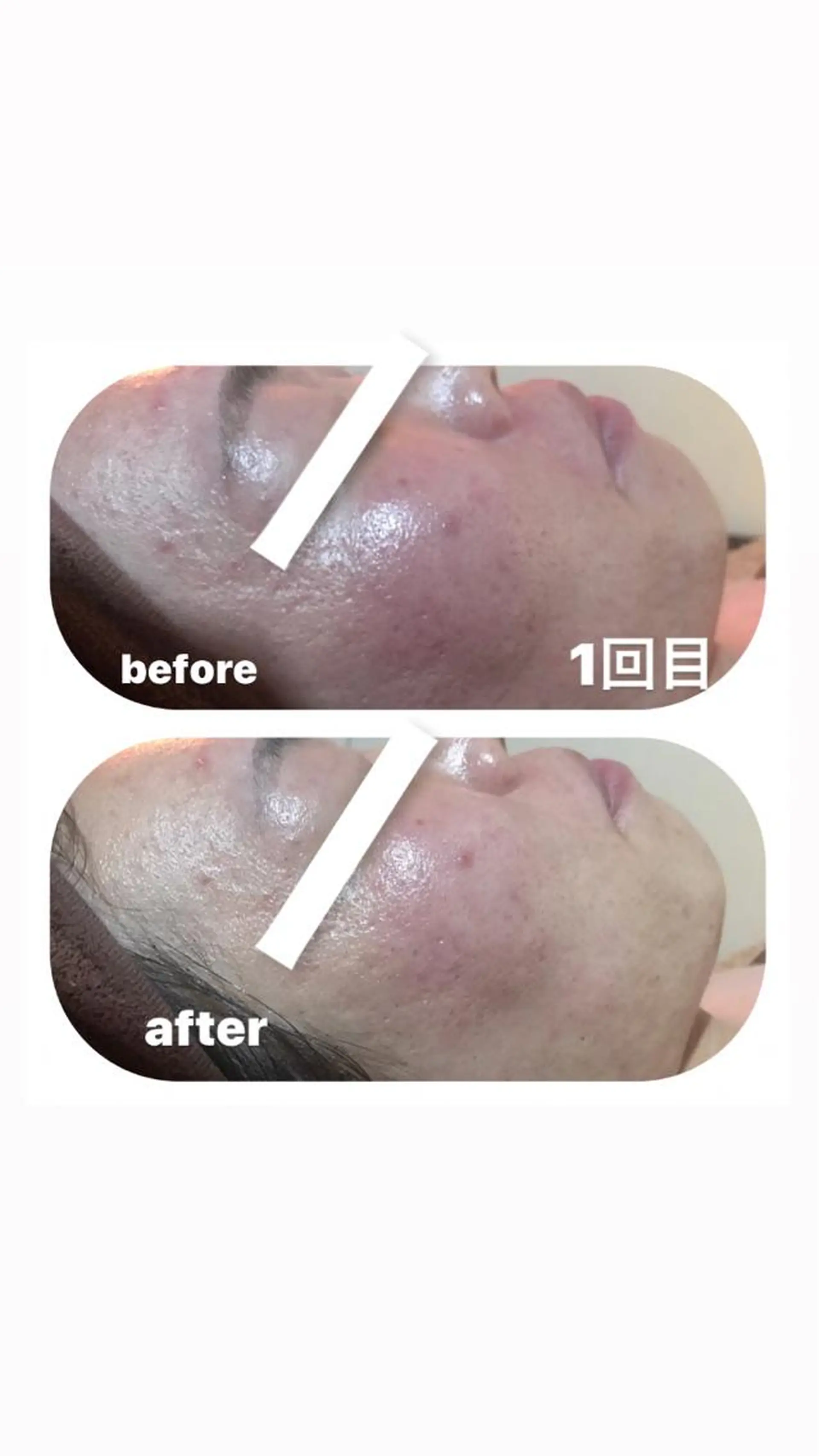 エステ 【足圧】鬼👹リンパ 身体整うサロンのエステ・リラクイメージ