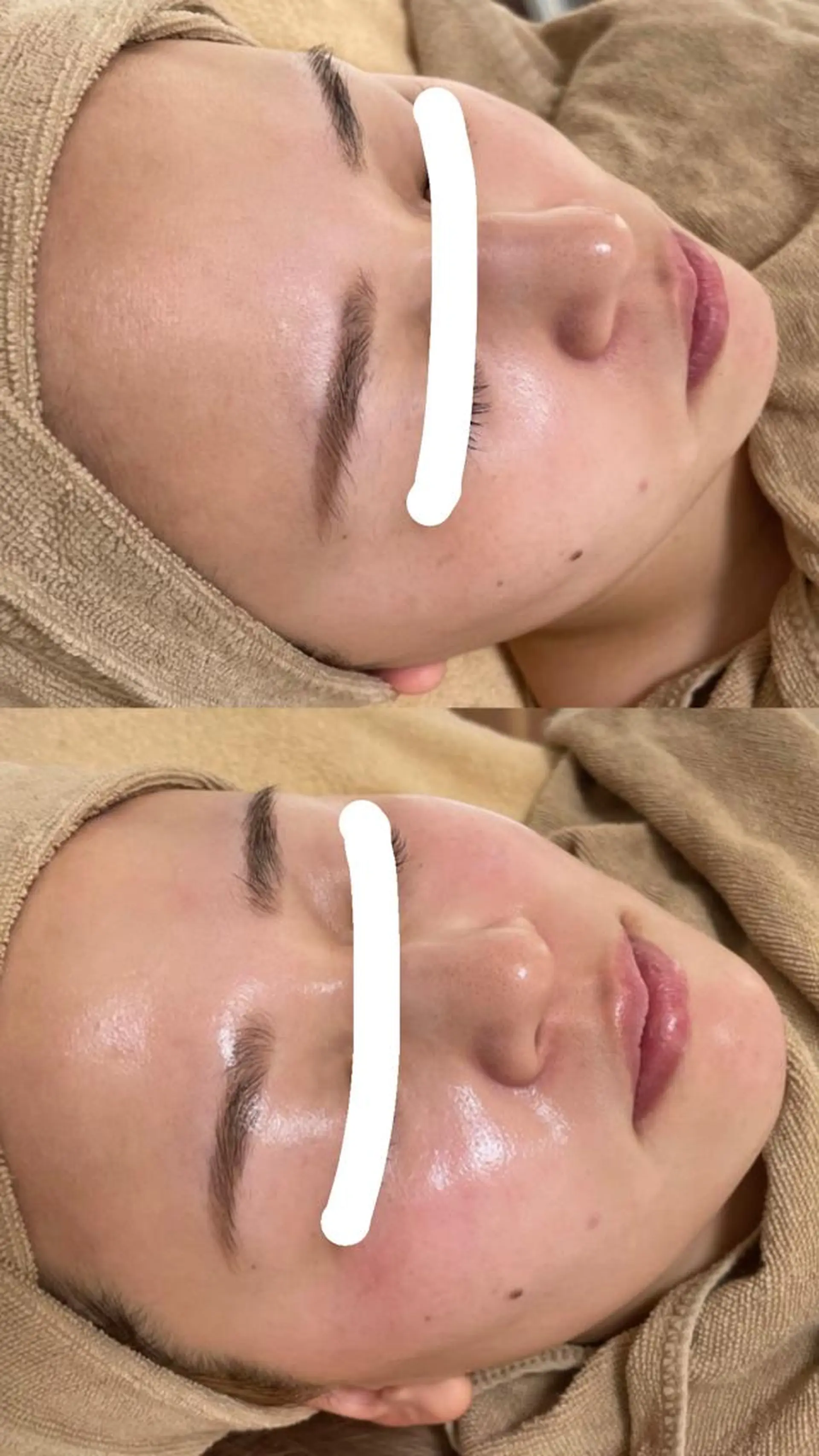 脱毛 エステサロン Mi-mi.iのエステ・リラクイメージ