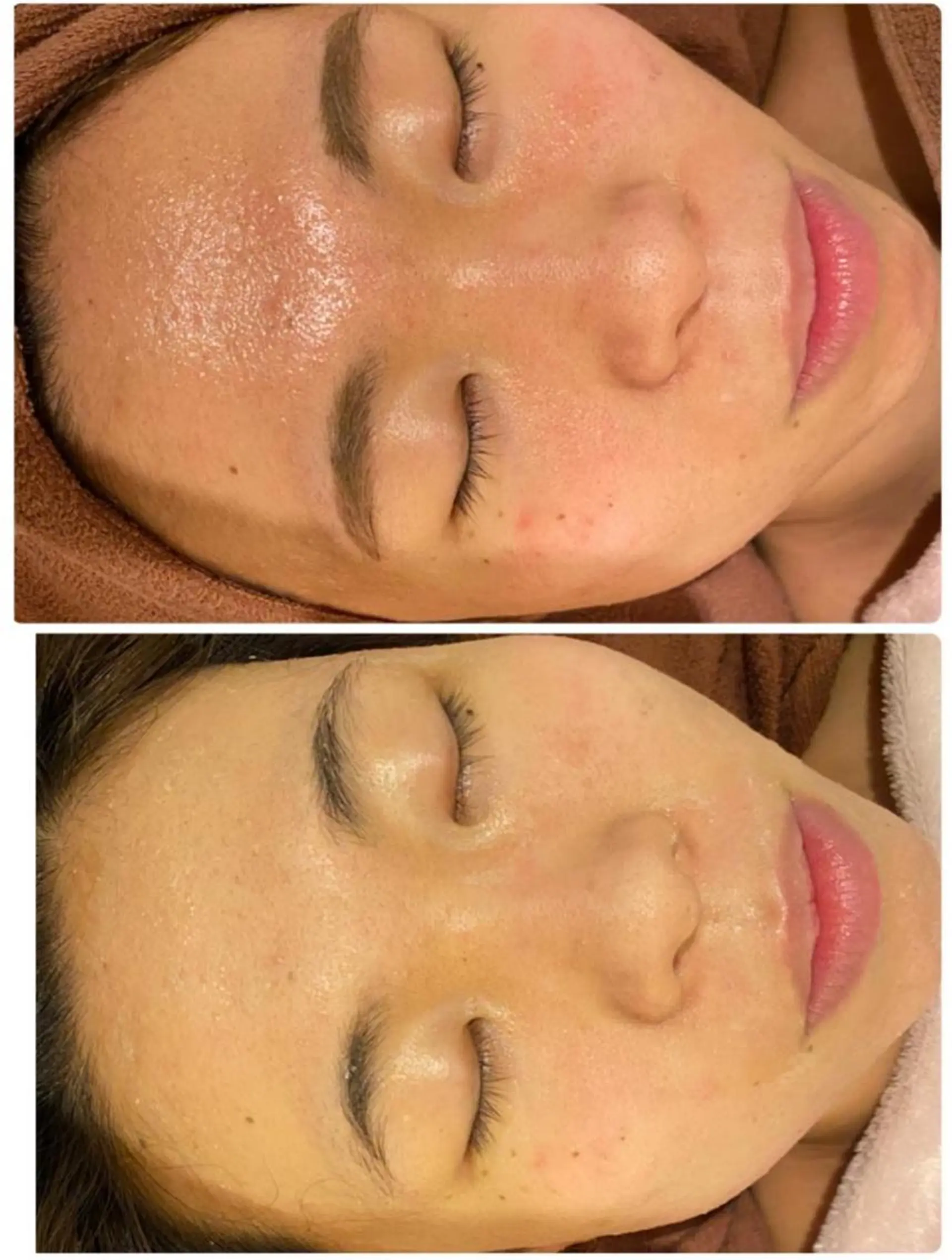 3か月で肌革命👼 ニキビ専門店💫のエステ・リラクイメージ